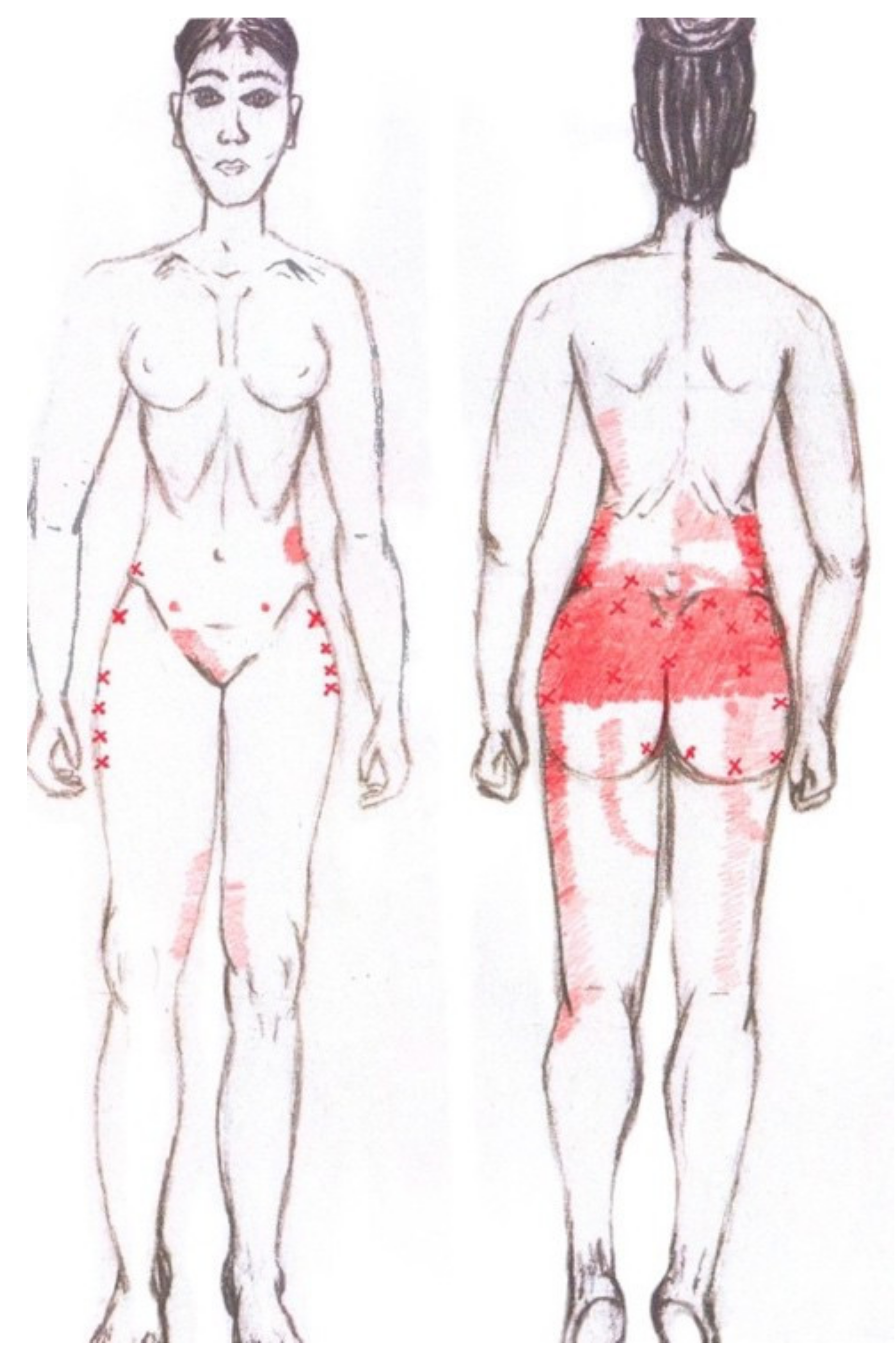 Diagnostics 12 02723 g008 Diagnostics 12 02723 g008