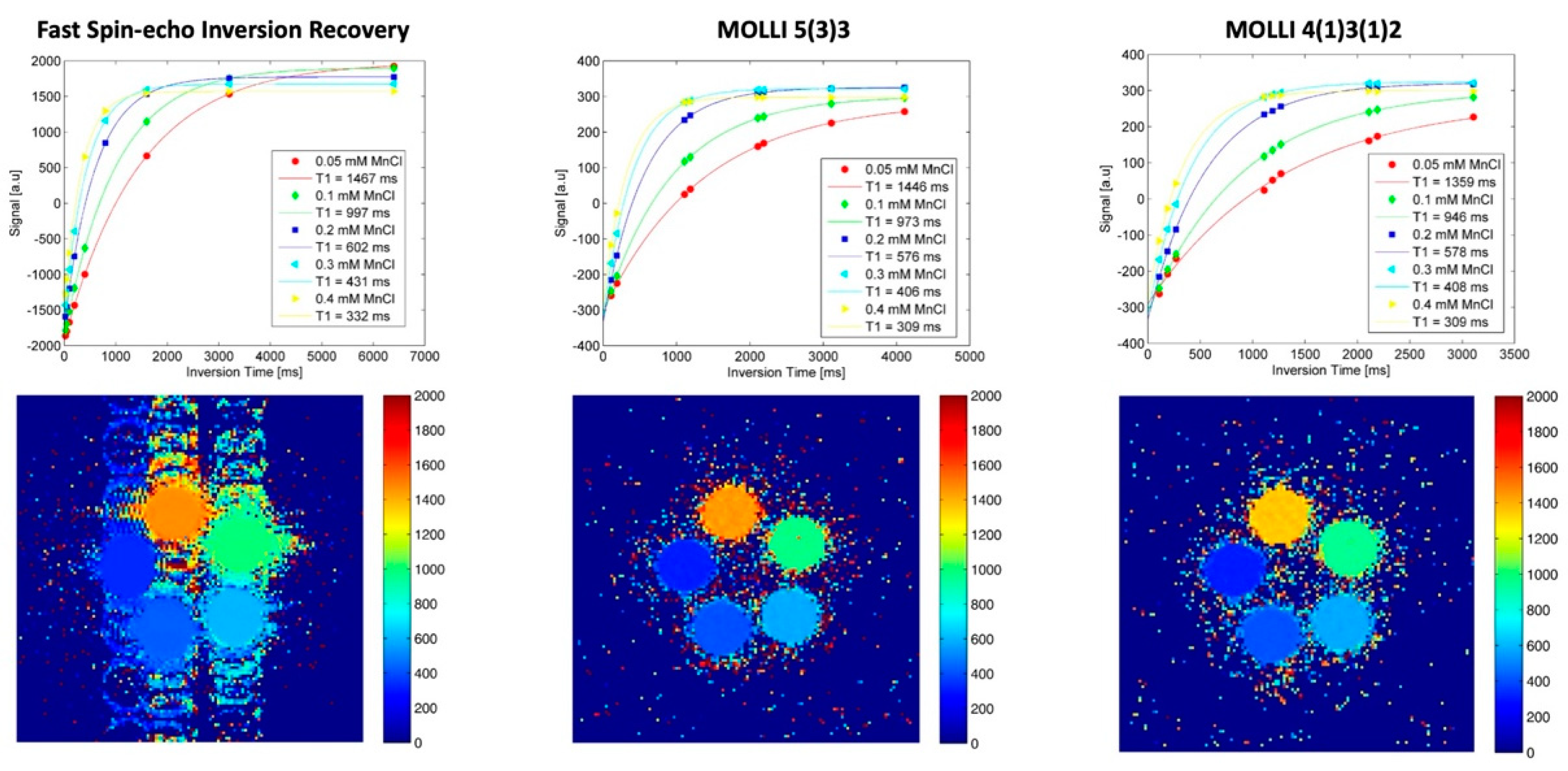 Global longitudinal strain calculation from phantom model (normal