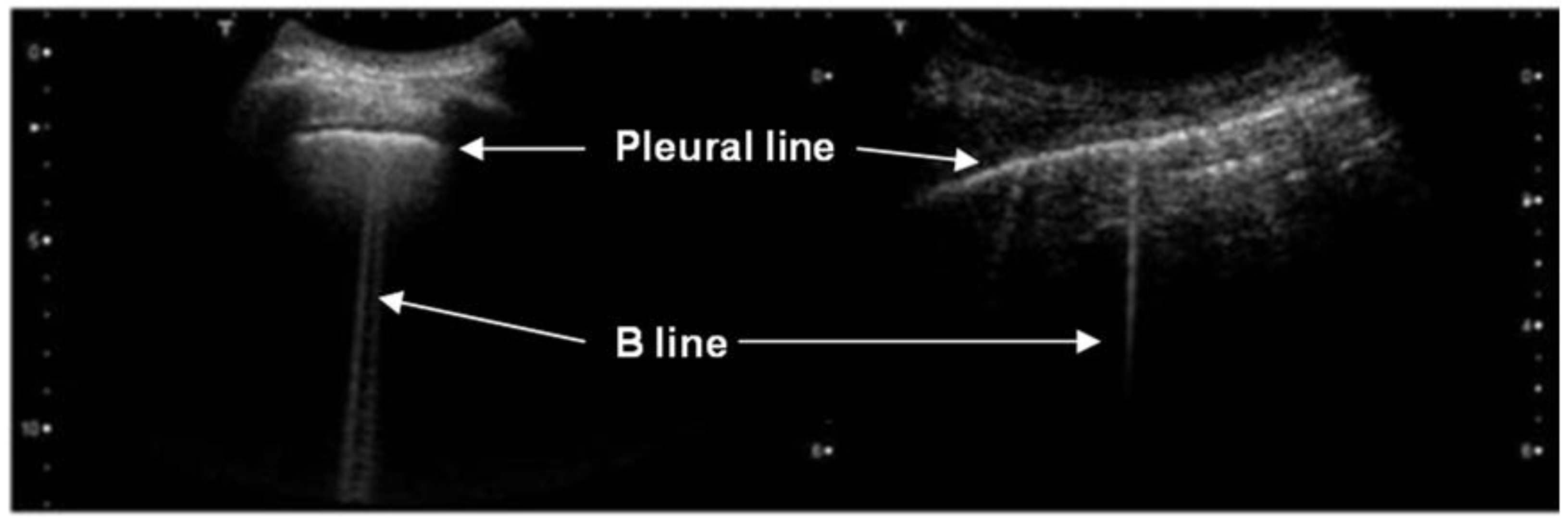 Diagnostics 12 02751 g002 Diagnostics 12 02751 g002