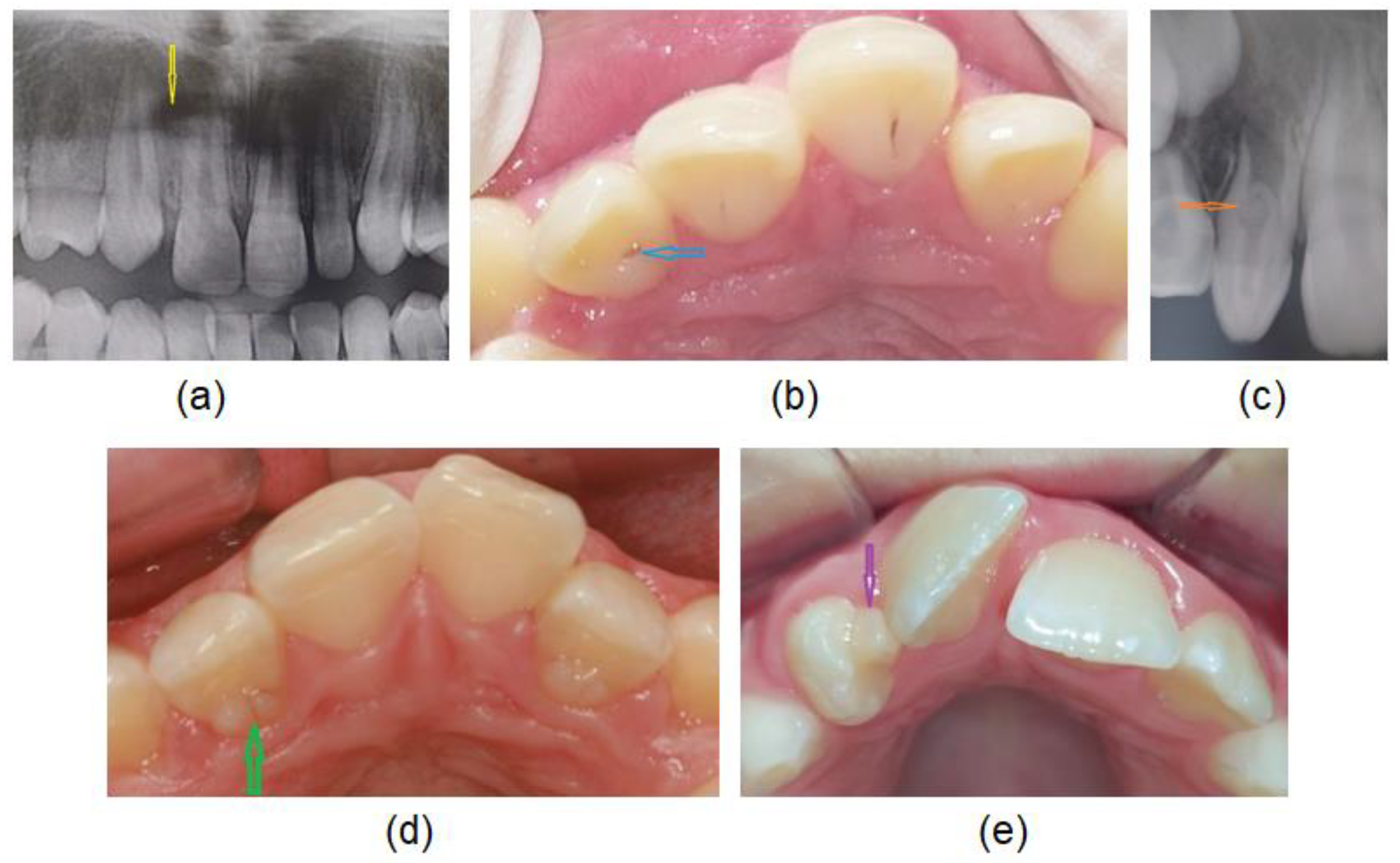 Diagnostics Free FullText Morphological Diversity of Permanent