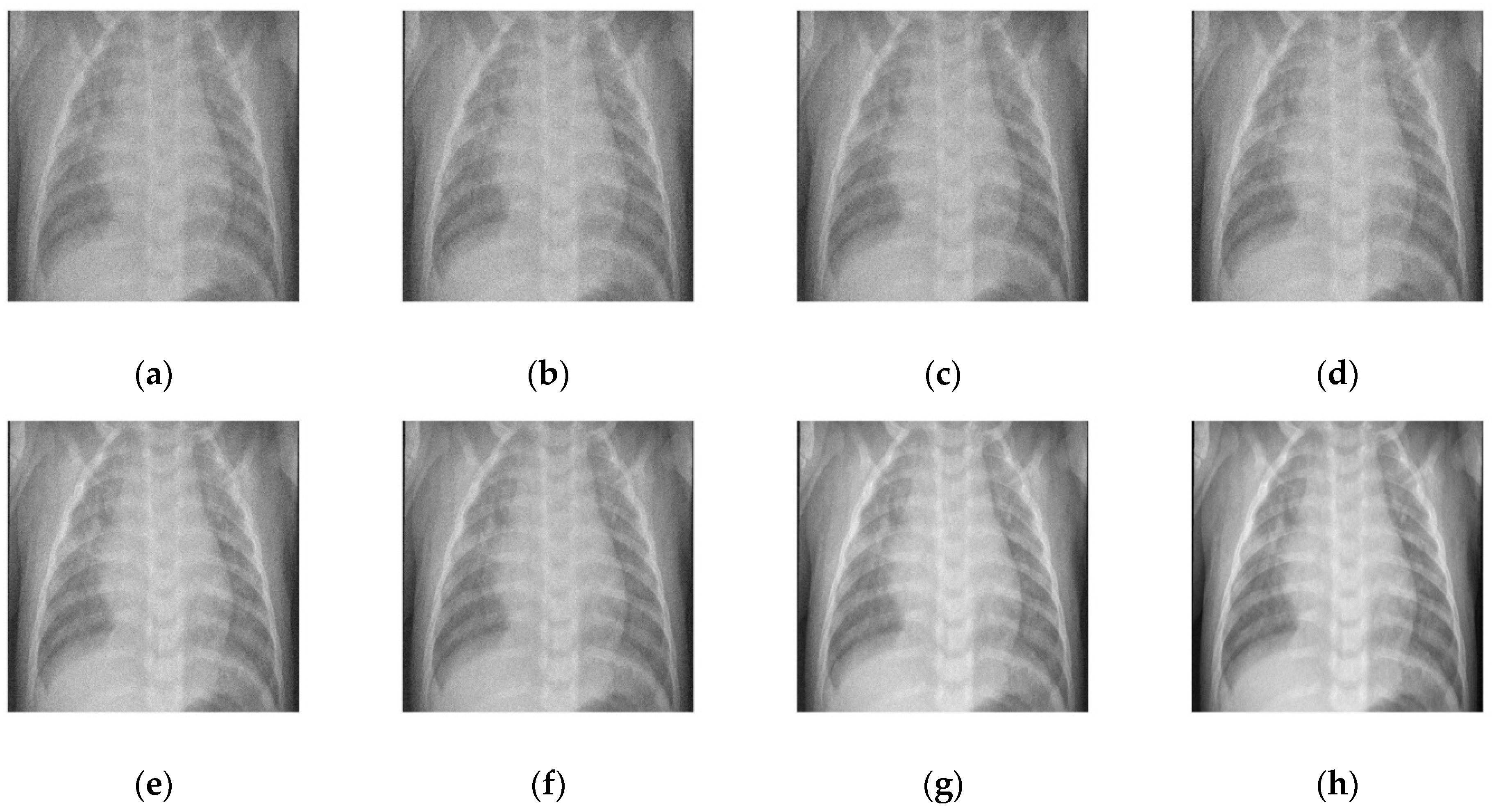 Diagnostics 12 02766 g007 Diagnostics 12 02766 g007