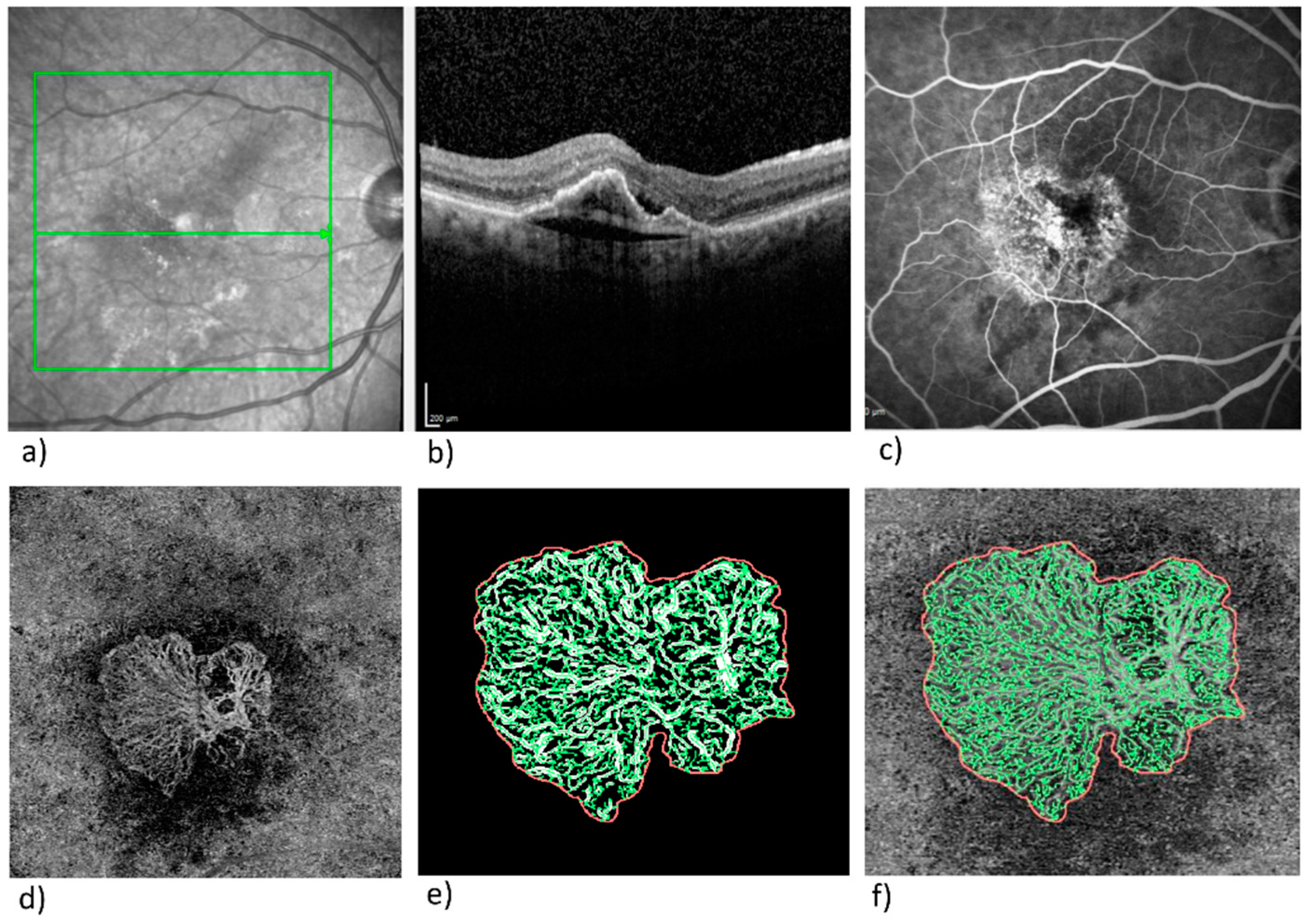Diagnostics 12 02807 g001 Diagnostics 12 02807 g001