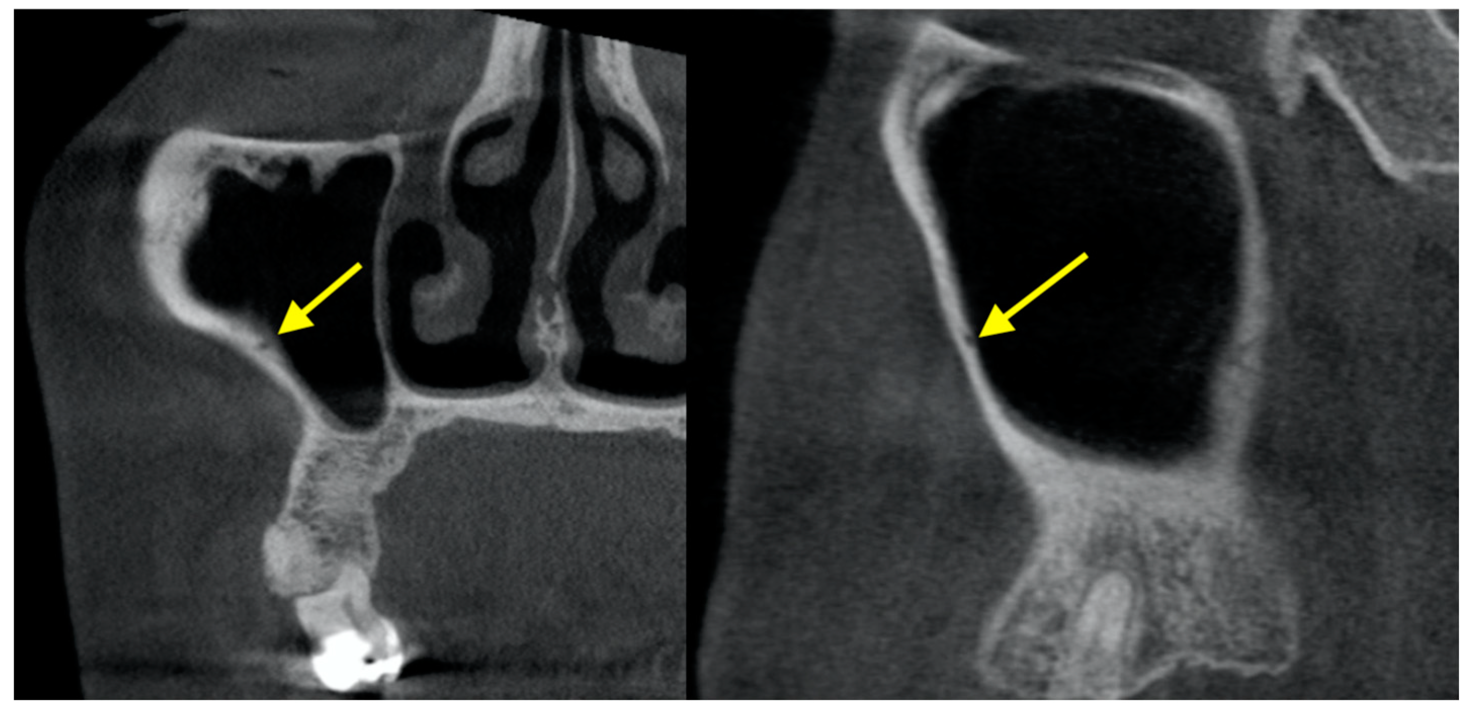 Diagnostics Free Full Text The Use Of Cbct In Evaluating The Health And Pathology Of The