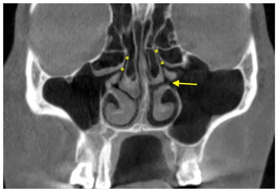 Diagnostics Free Full Text The Use Of Cbct In Evaluating The Health And Pathology Of The