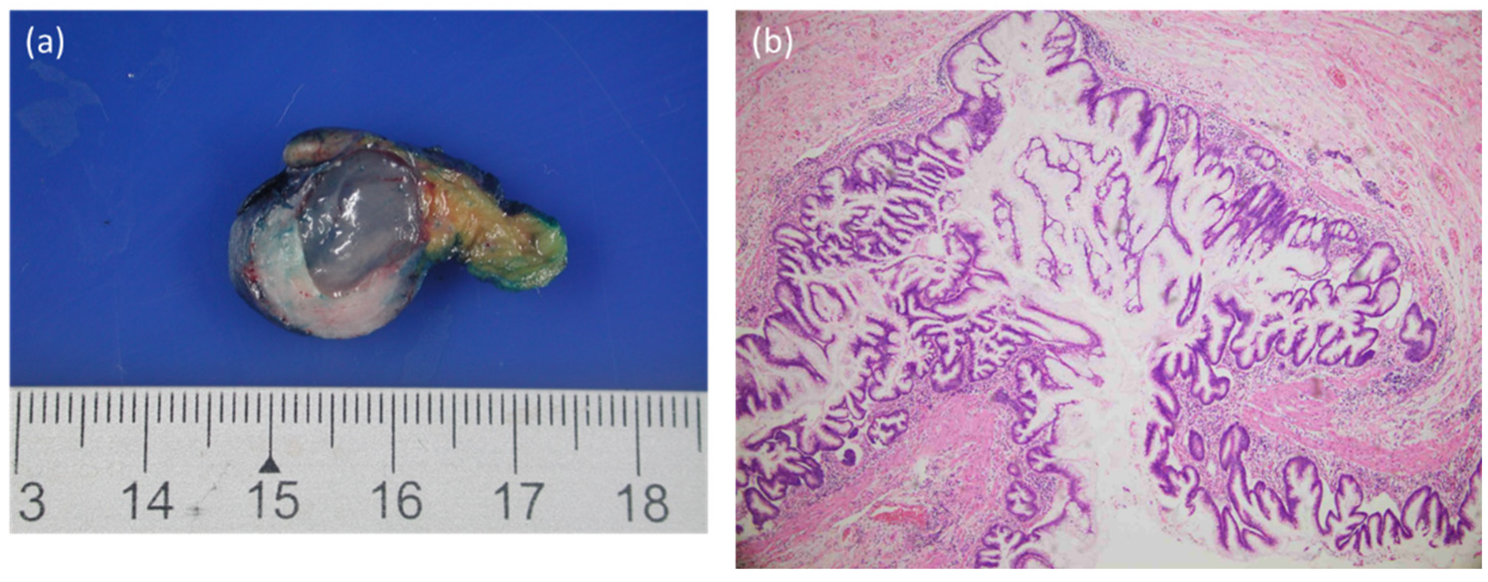 Diagnostics 12 02832 g004 Diagnostics 12 02832 g004