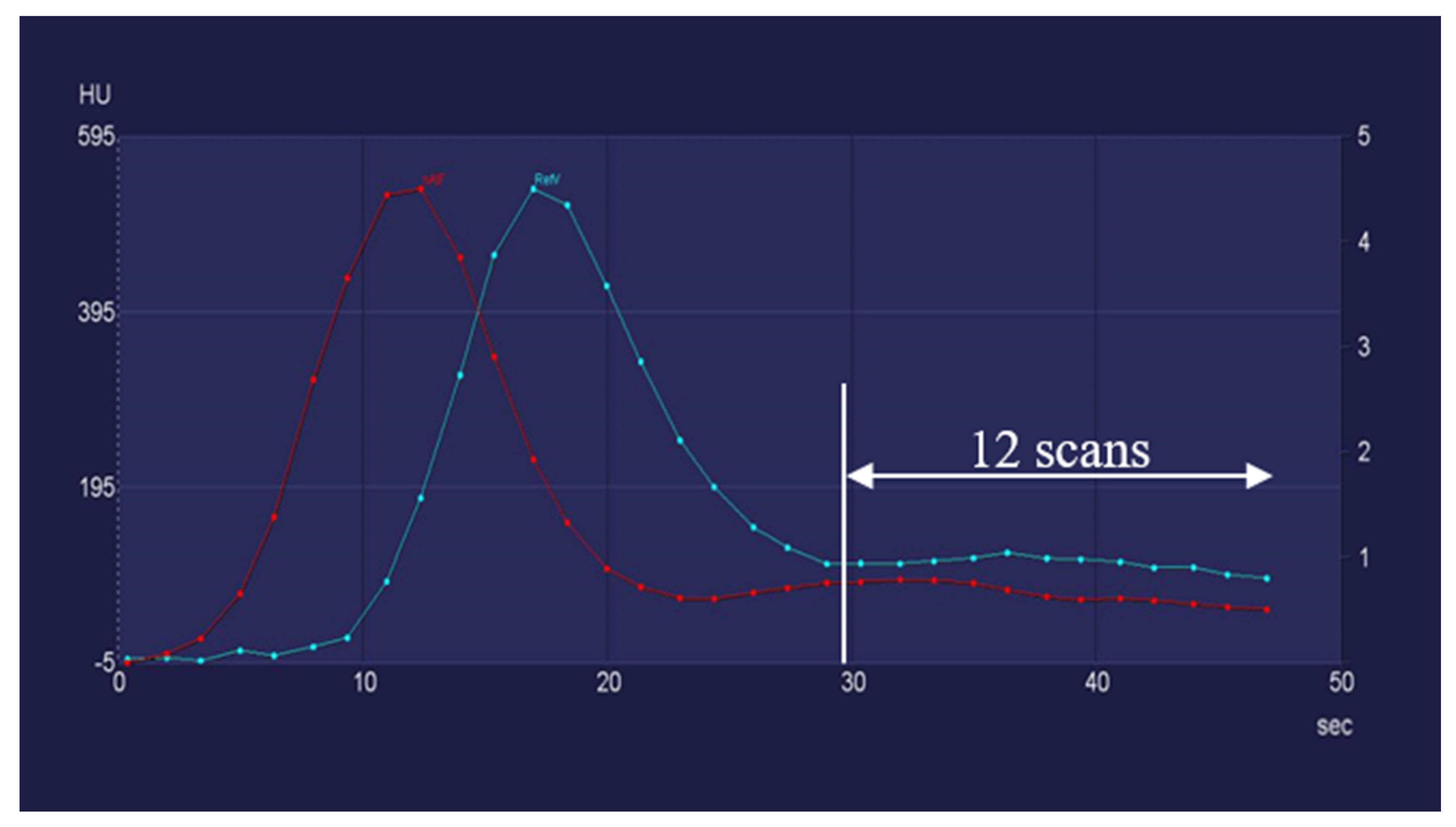 Diagnostics | Free Full-Text | Reduction in Radiation Exposure of CT ...