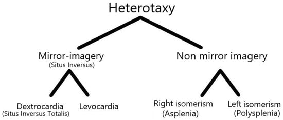 Diagnostics Free Full Text Splenic Torsion In Heterotaxy Syndrome