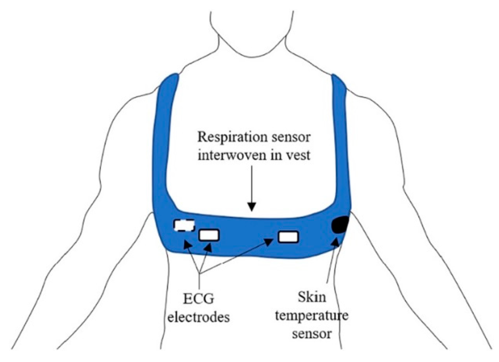 Diagnostics | Free Full-Text | Wearable Sensors and Artificial ...