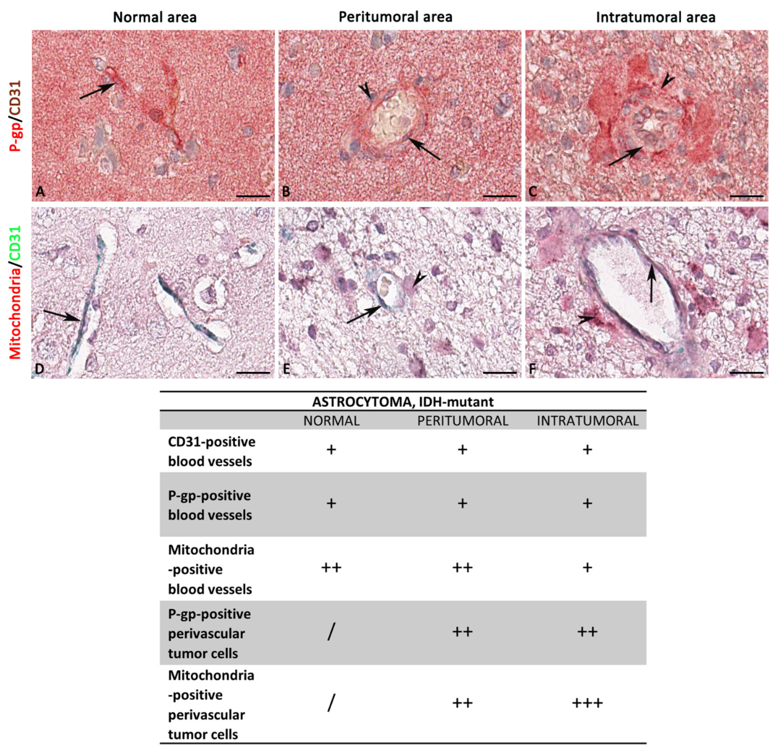 Diagnostics 12 03120 g006 Diagnostics 12 03120 g006