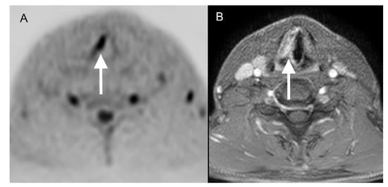 Diagnostics | Free Full-Text | Additional Diffusion-Weighted Imaging ...