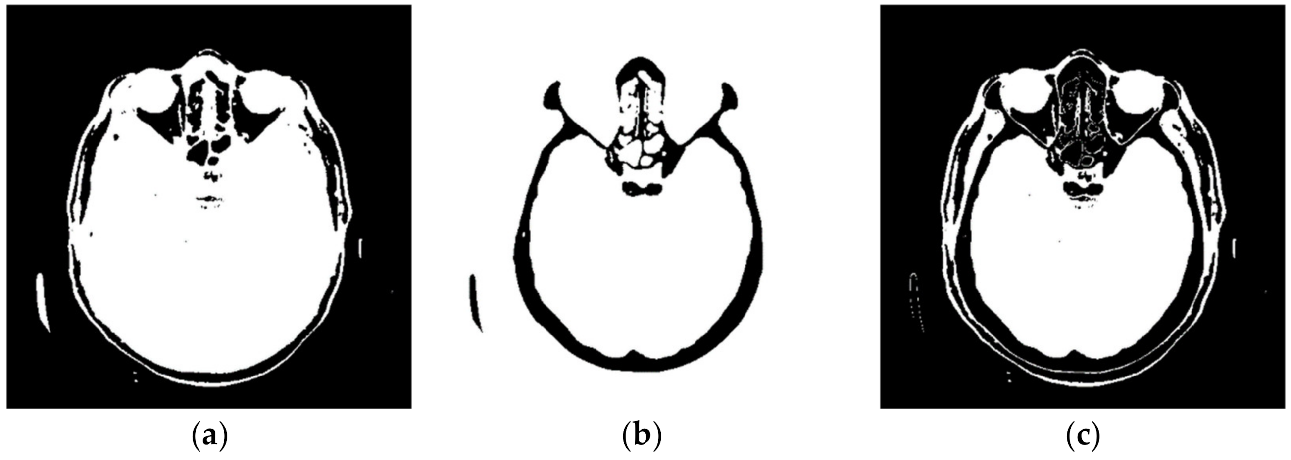 Diagnostics 12 03208 g005 Diagnostics 12 03208 g005