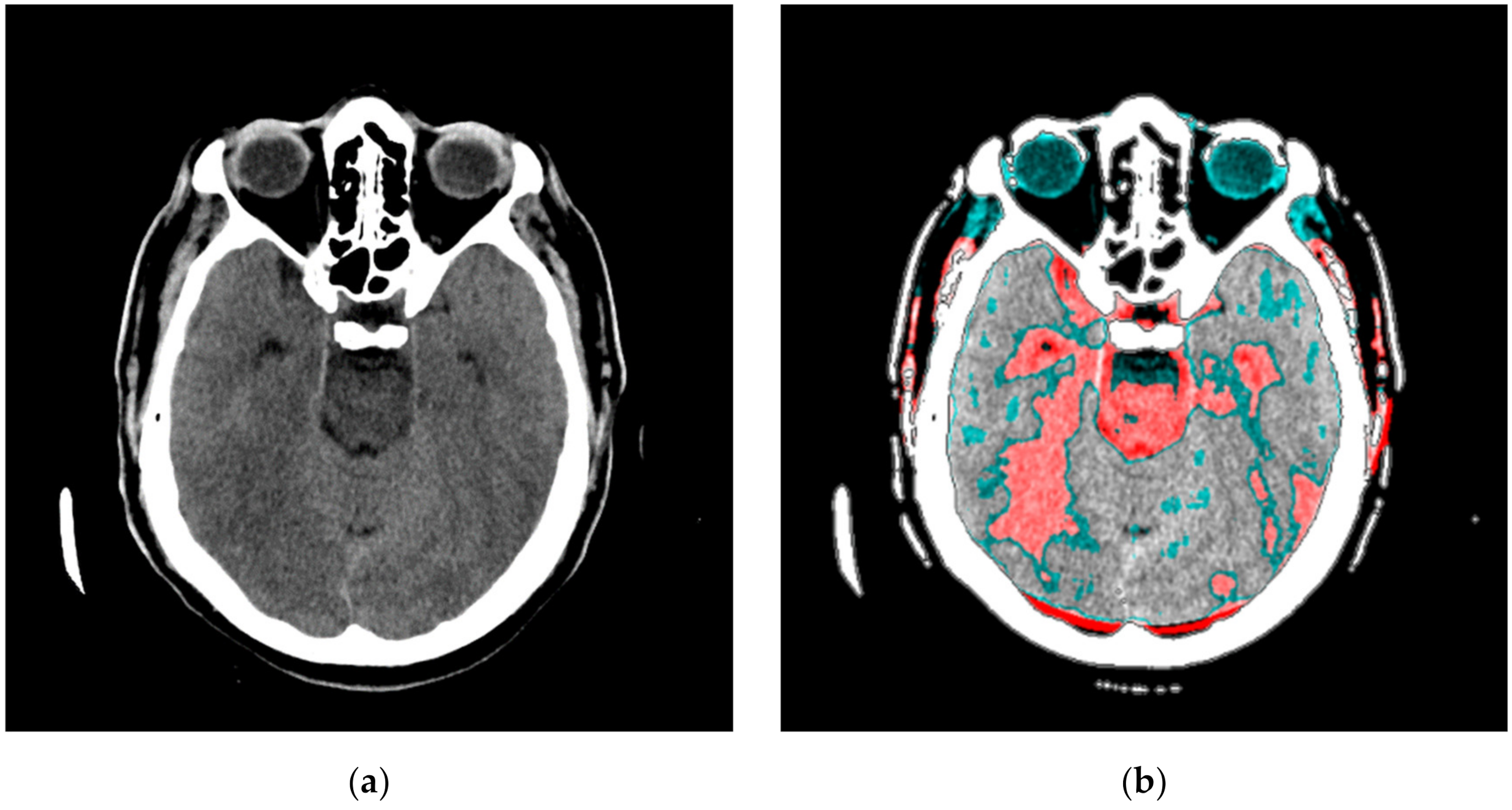 Diagnostics 12 03208 g0a2 Diagnostics 12 03208 g0a2