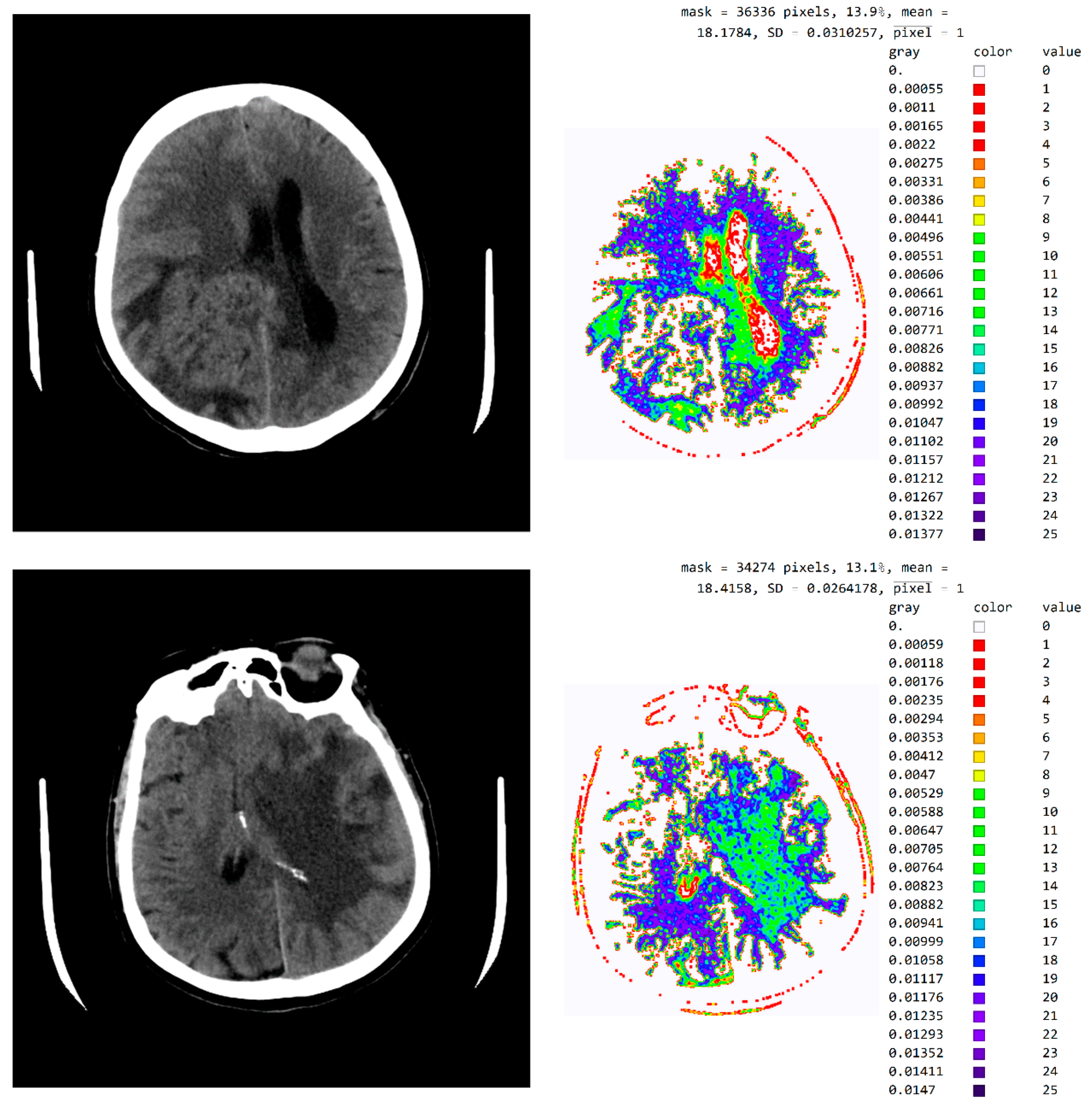 Diagnostics 12 03208 g0a3a Diagnostics 12 03208 g0a3a