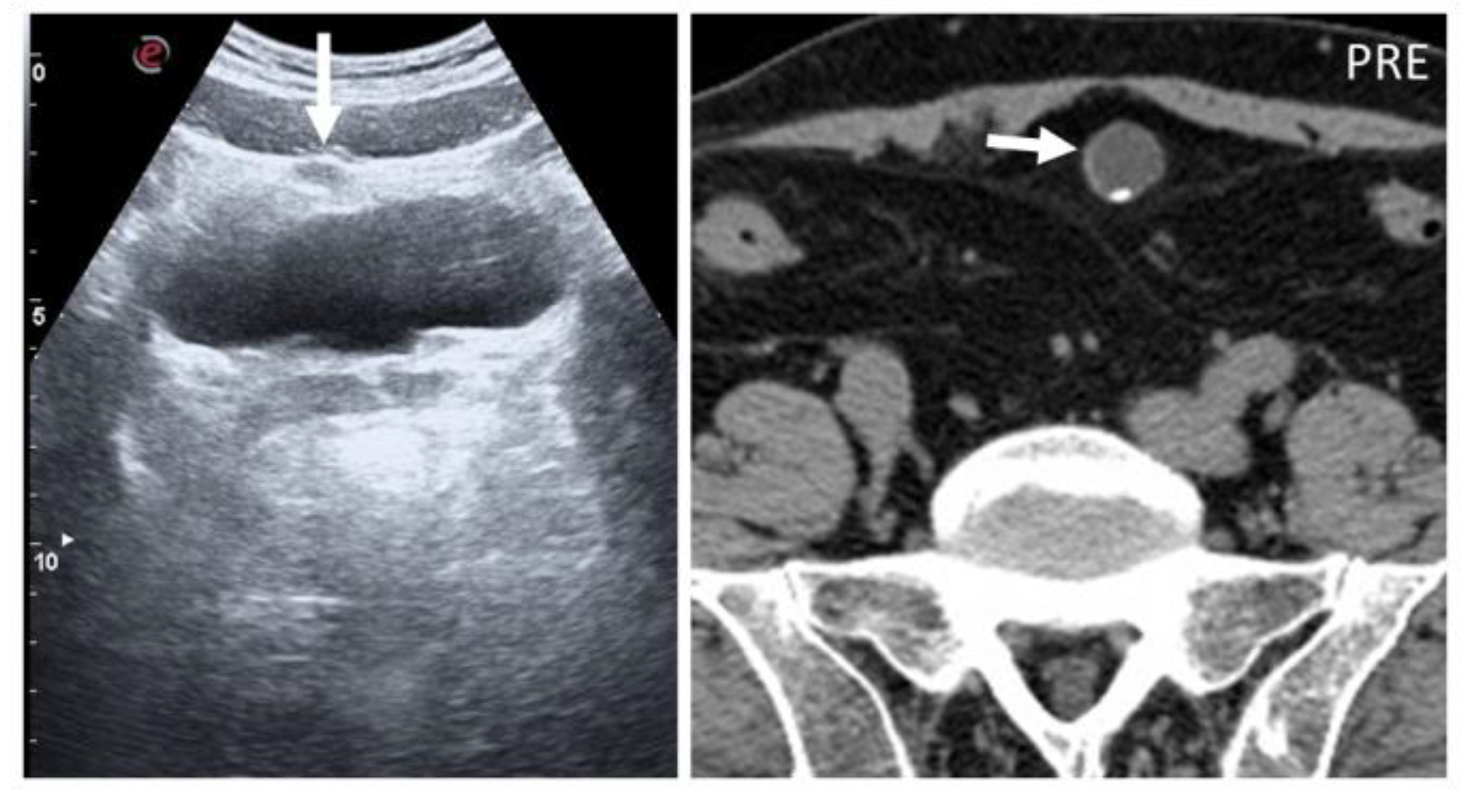 Diagnostics 12 03211 g005 Diagnostics 12 03211 g005