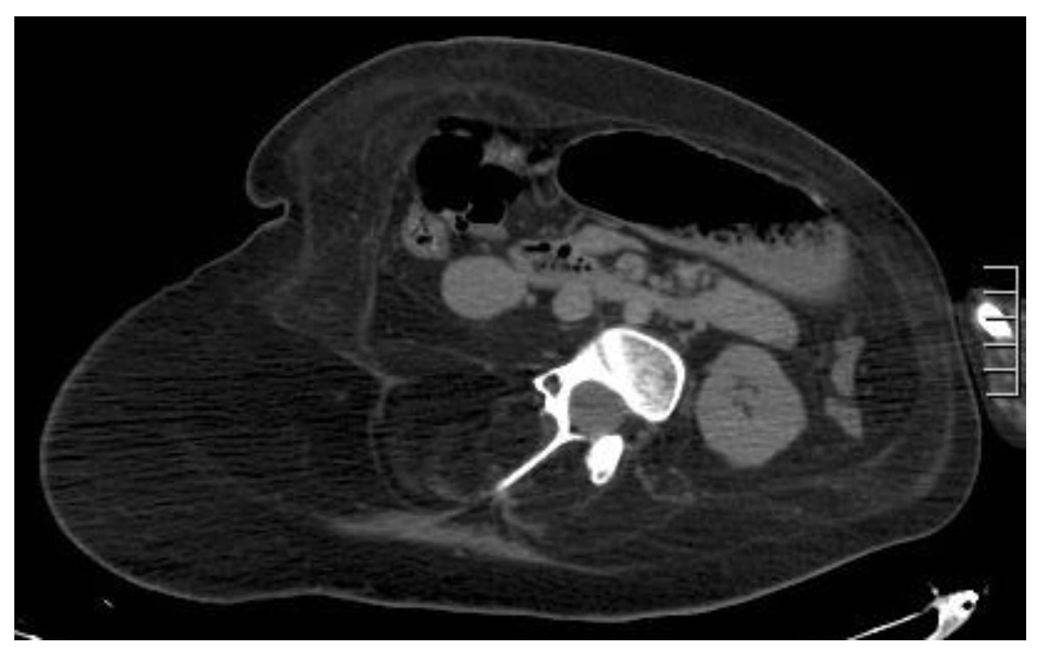 Diagnostics 12 03211 g007 Diagnostics 12 03211 g007