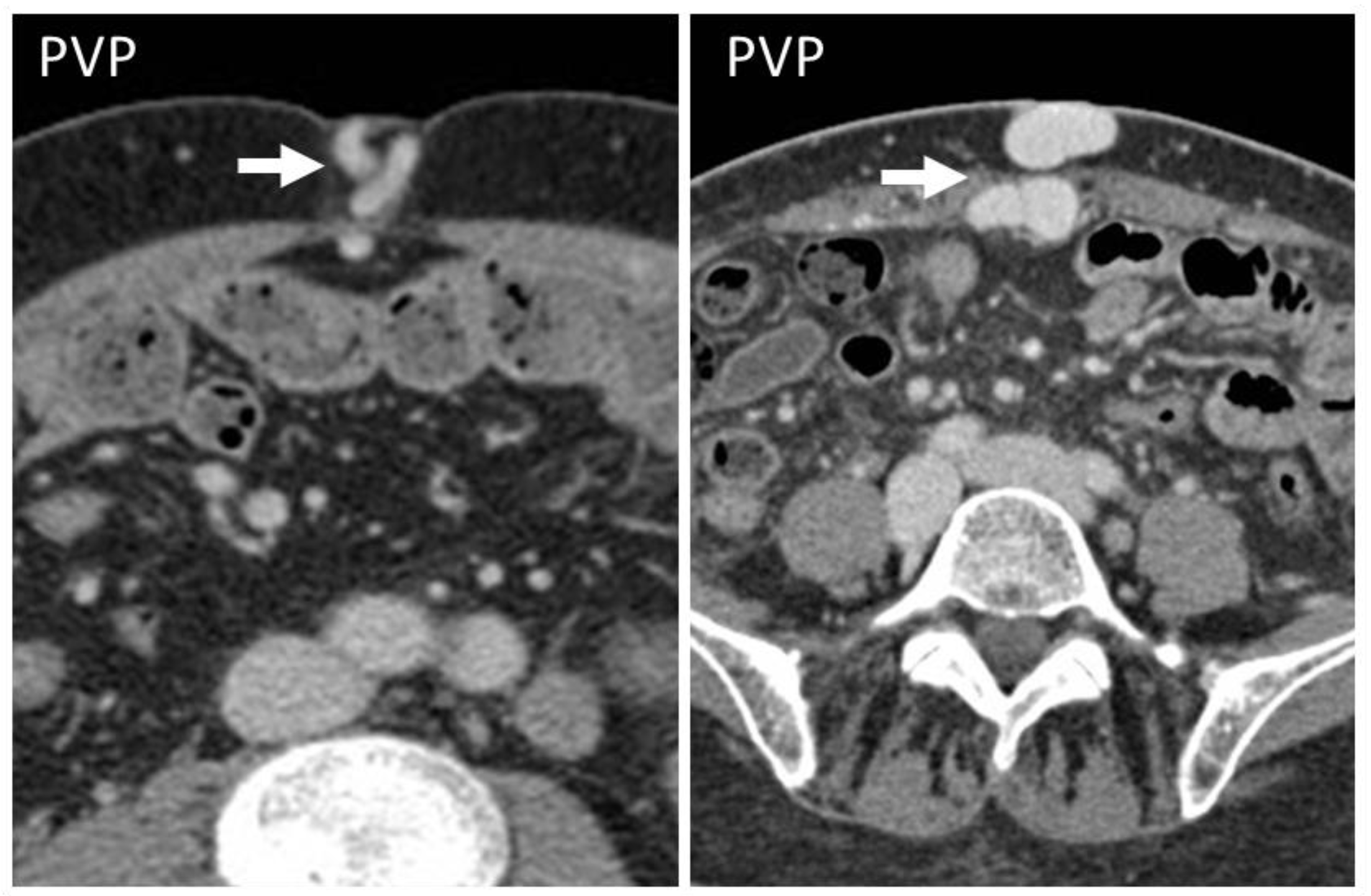 Diagnostics 12 03211 g008 Diagnostics 12 03211 g008
