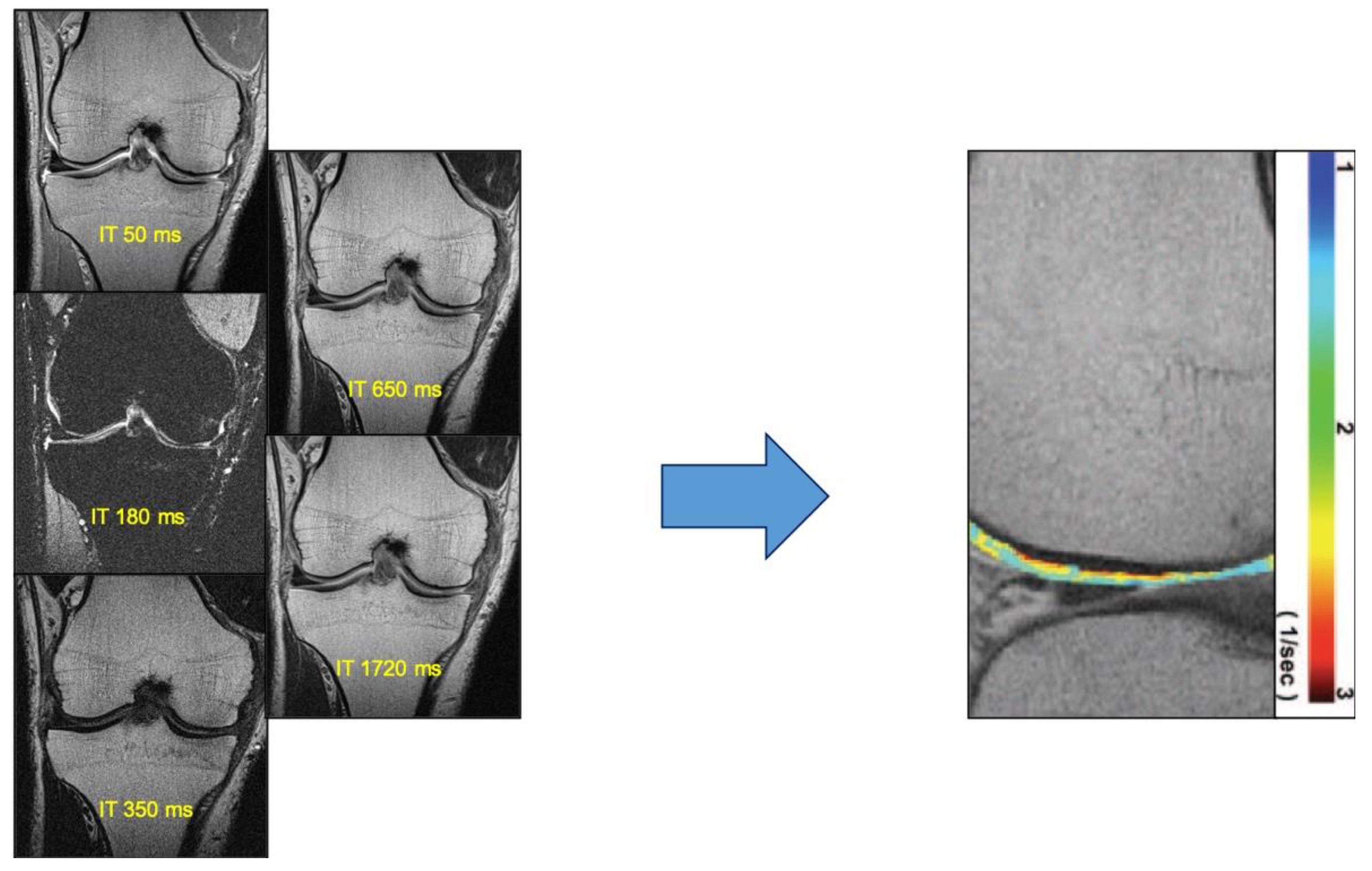 Diagnostics | Free Full-Text | Advanced MR Imaging for Knee