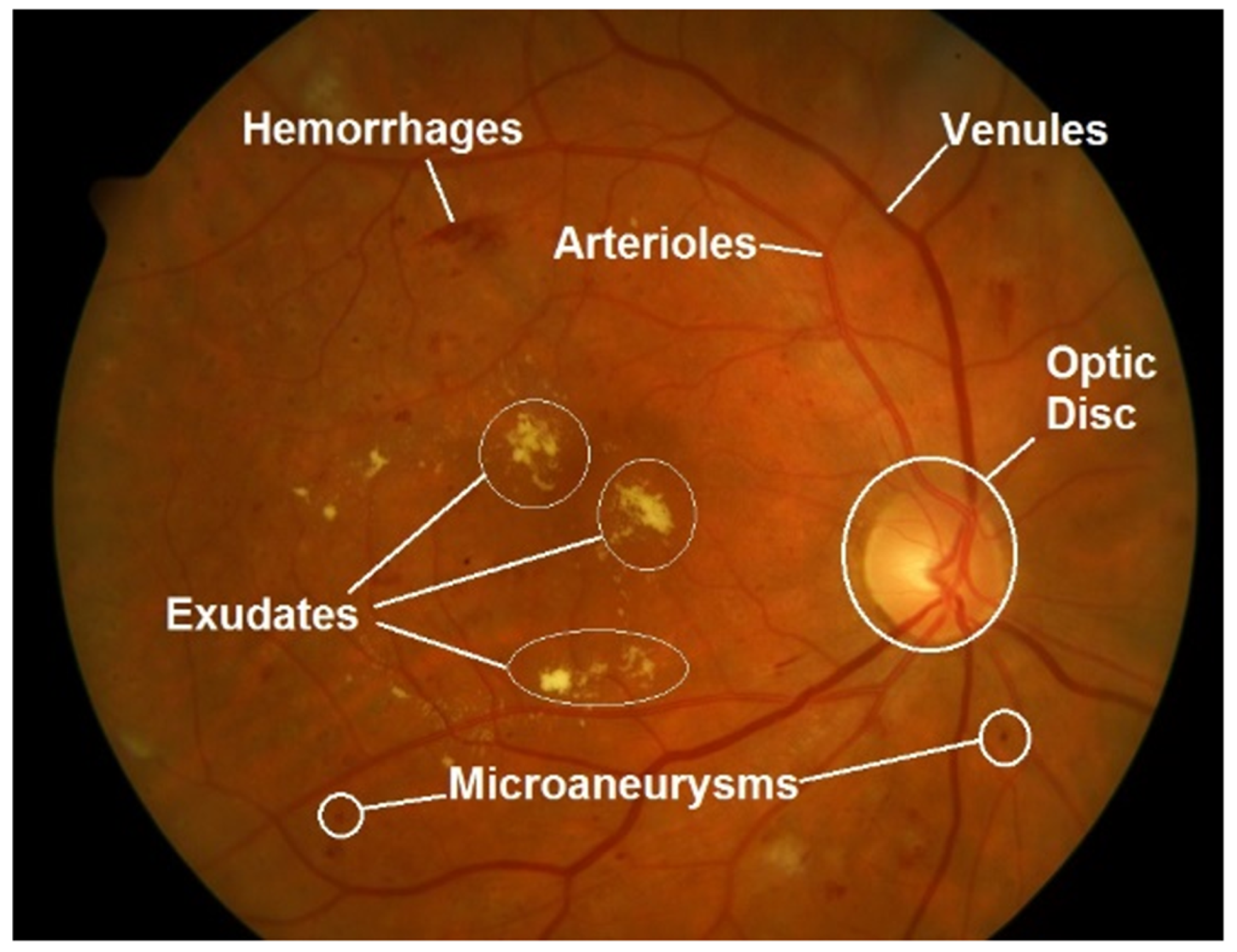 Diagnostics 13 00068 g002 Diagnostics 13 00068 g002