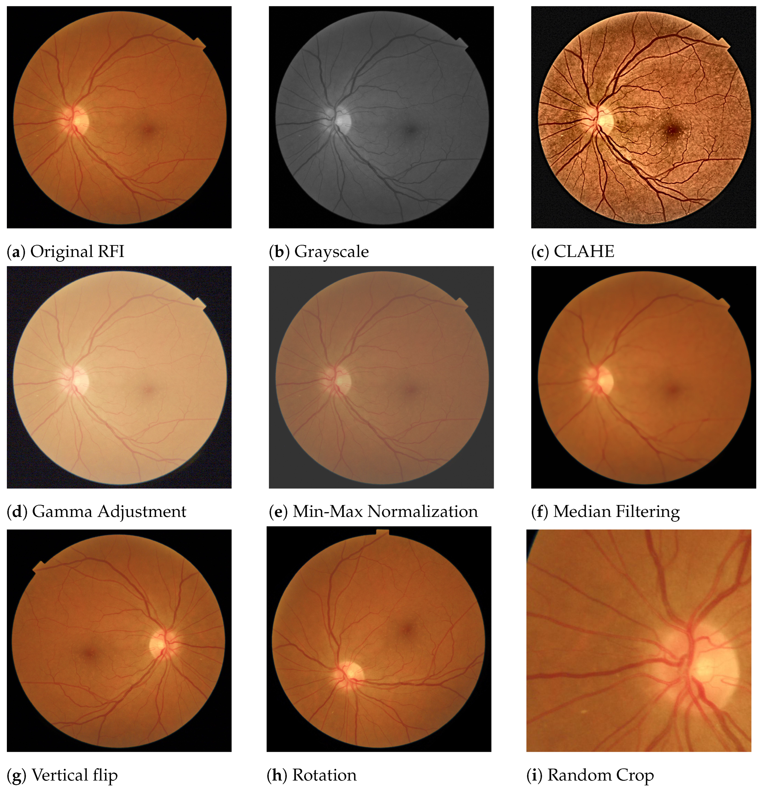 Diagnostics 13 00068 g004 Diagnostics 13 00068 g004