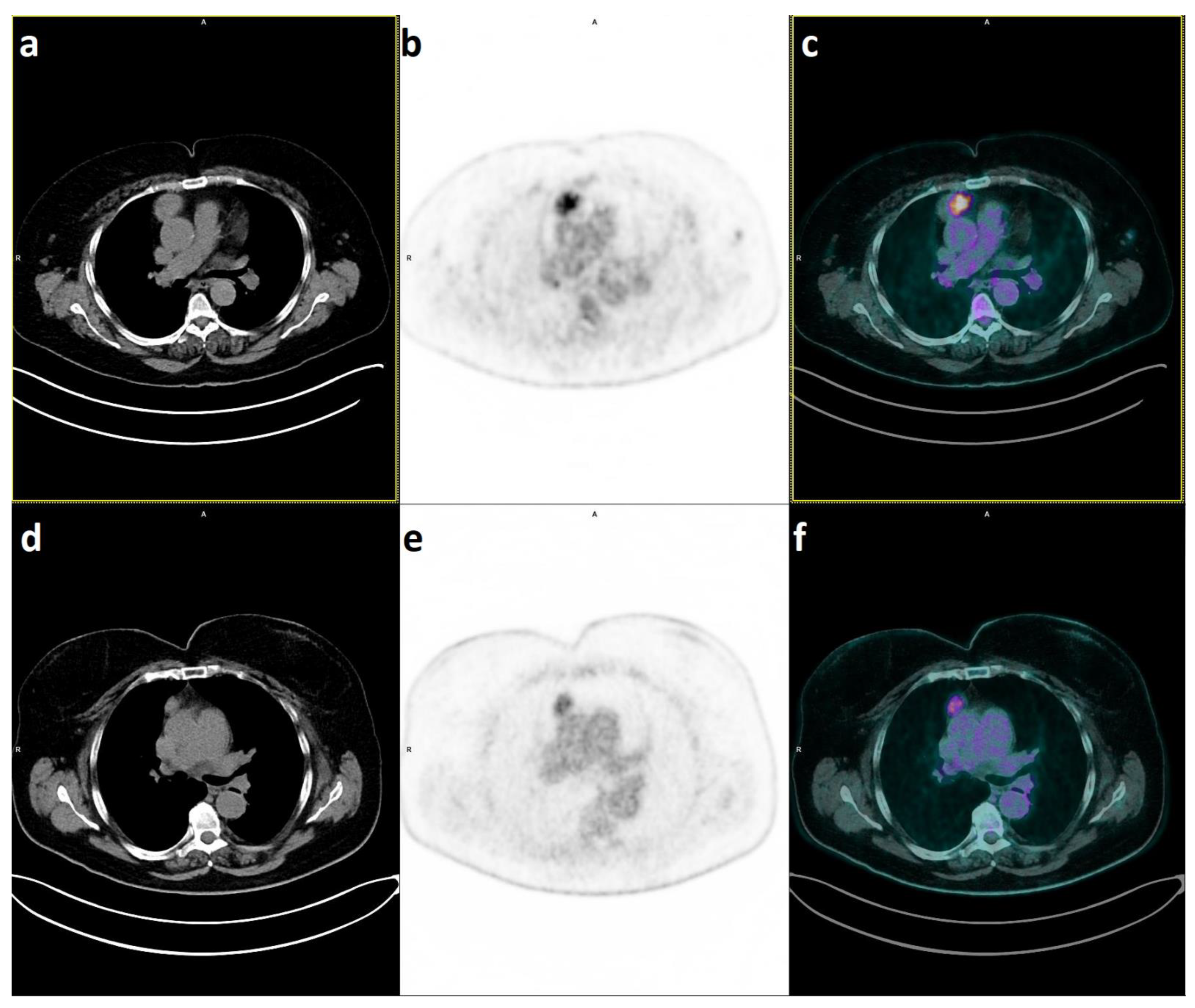 Diagnostics 13 00098 g002 Diagnostics 13 00098 g002