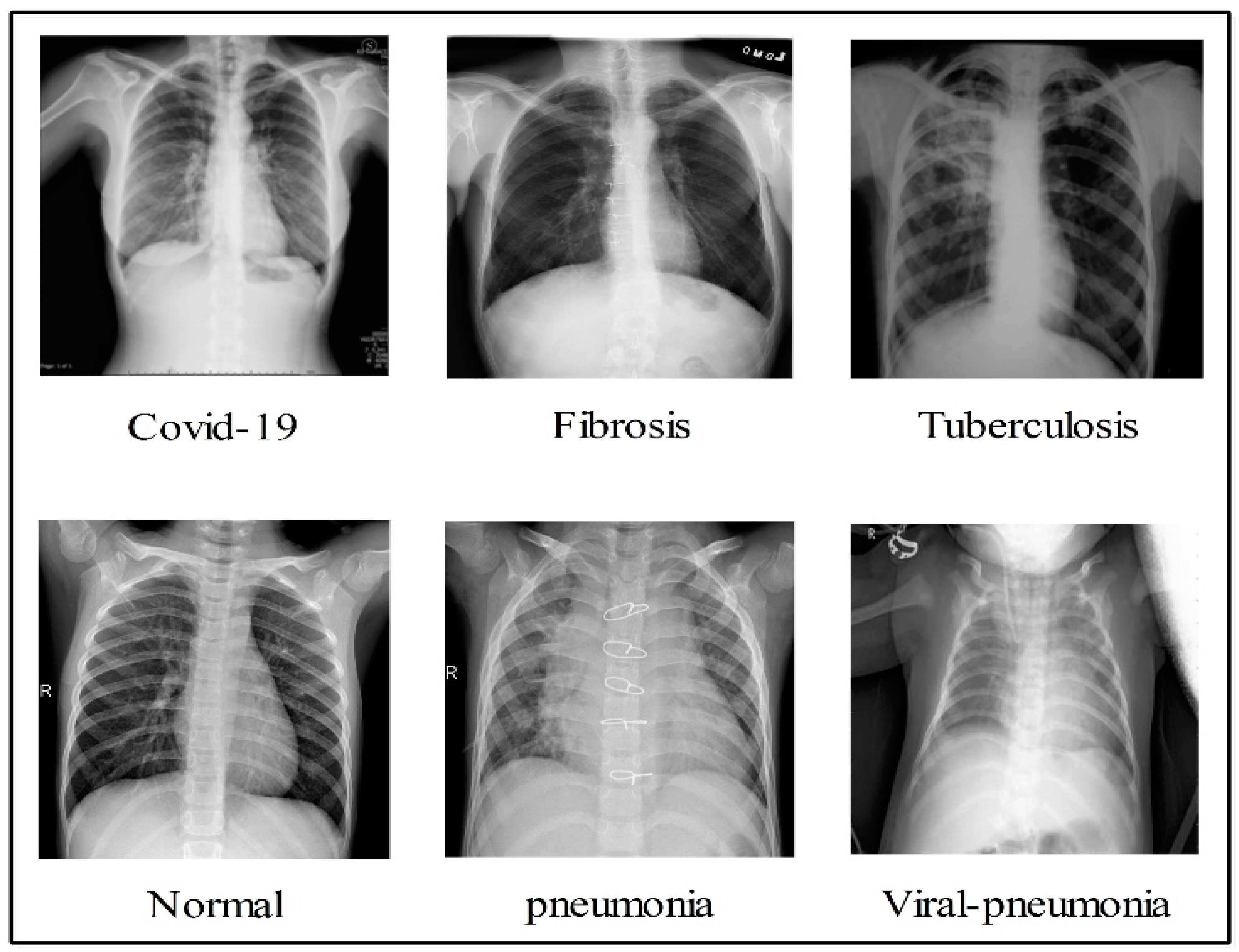 Diagnostics | Free Full-Text | D2BOF-COVIDNet: A Framework of Deep ...