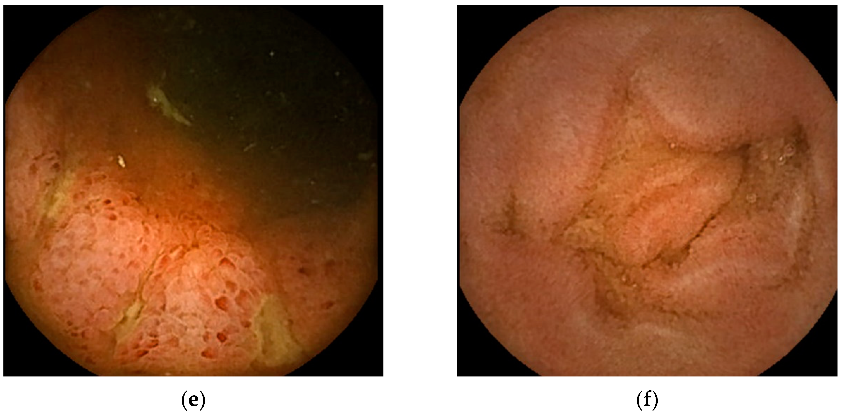 Diagnostics 13 00113 g002b Diagnostics 13 00113 g002b