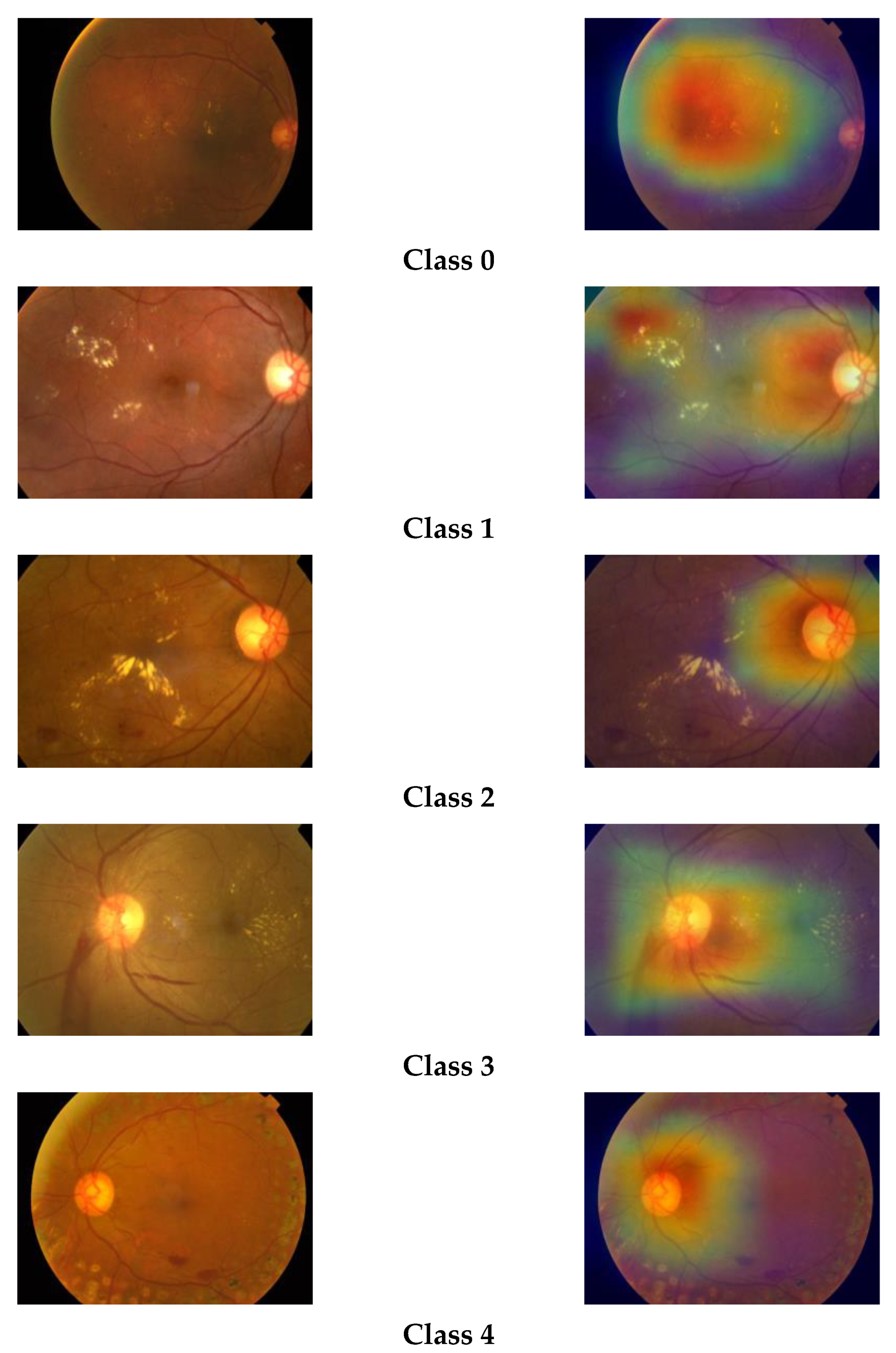 Diagnostics 13 00124 g008 Diagnostics 13 00124 g008