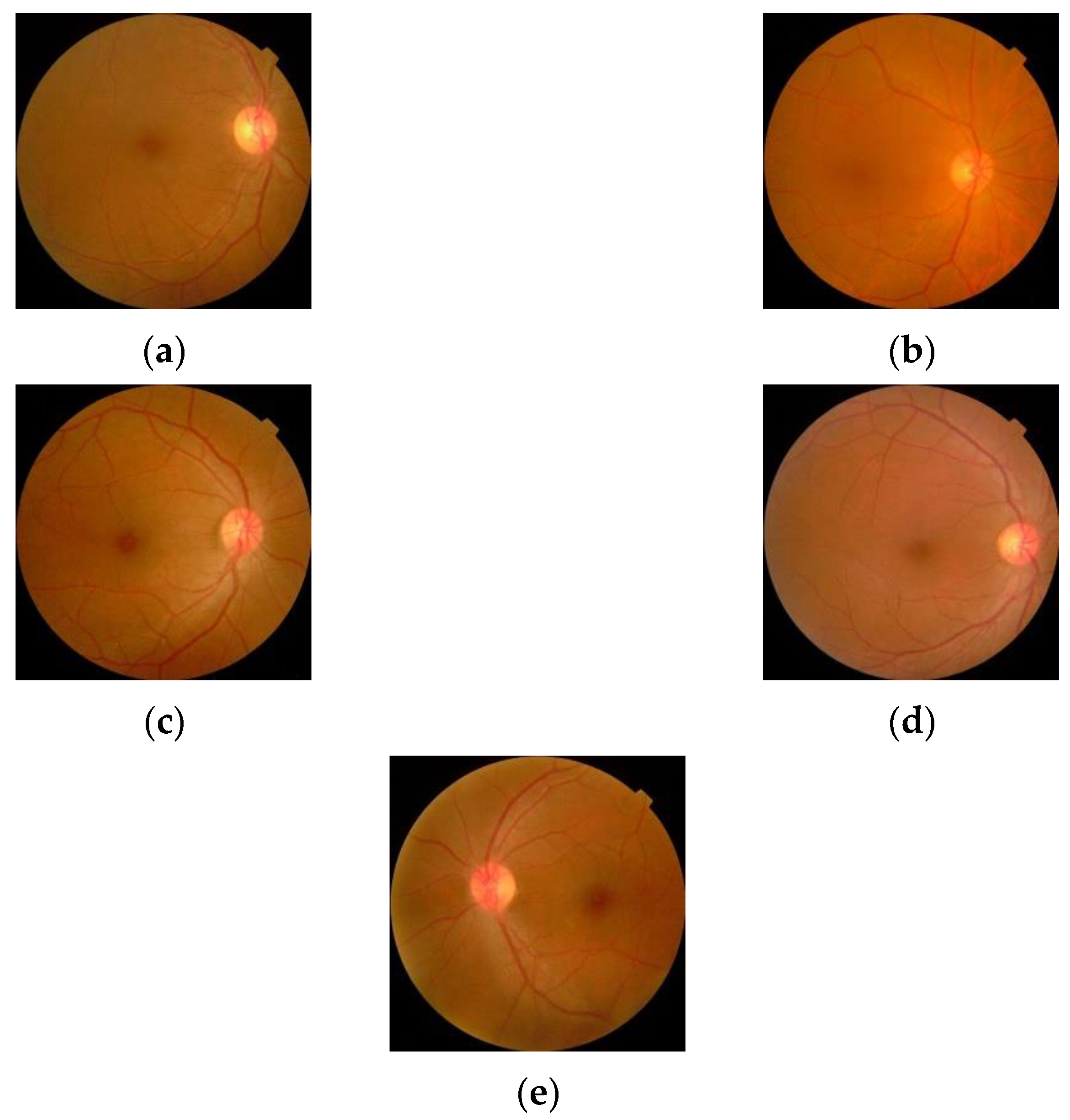 Diagnostics 13 00124 g010 Diagnostics 13 00124 g010