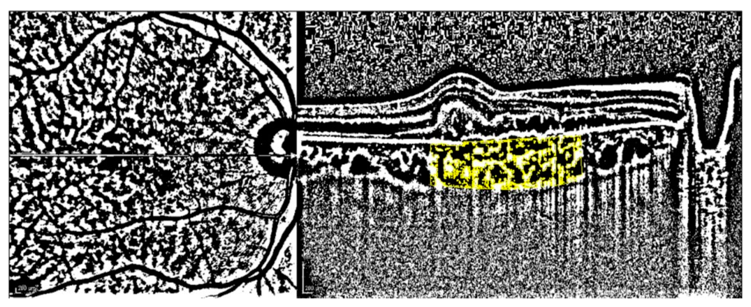 Diagnostics 13 00138 g001 Diagnostics 13 00138 g001