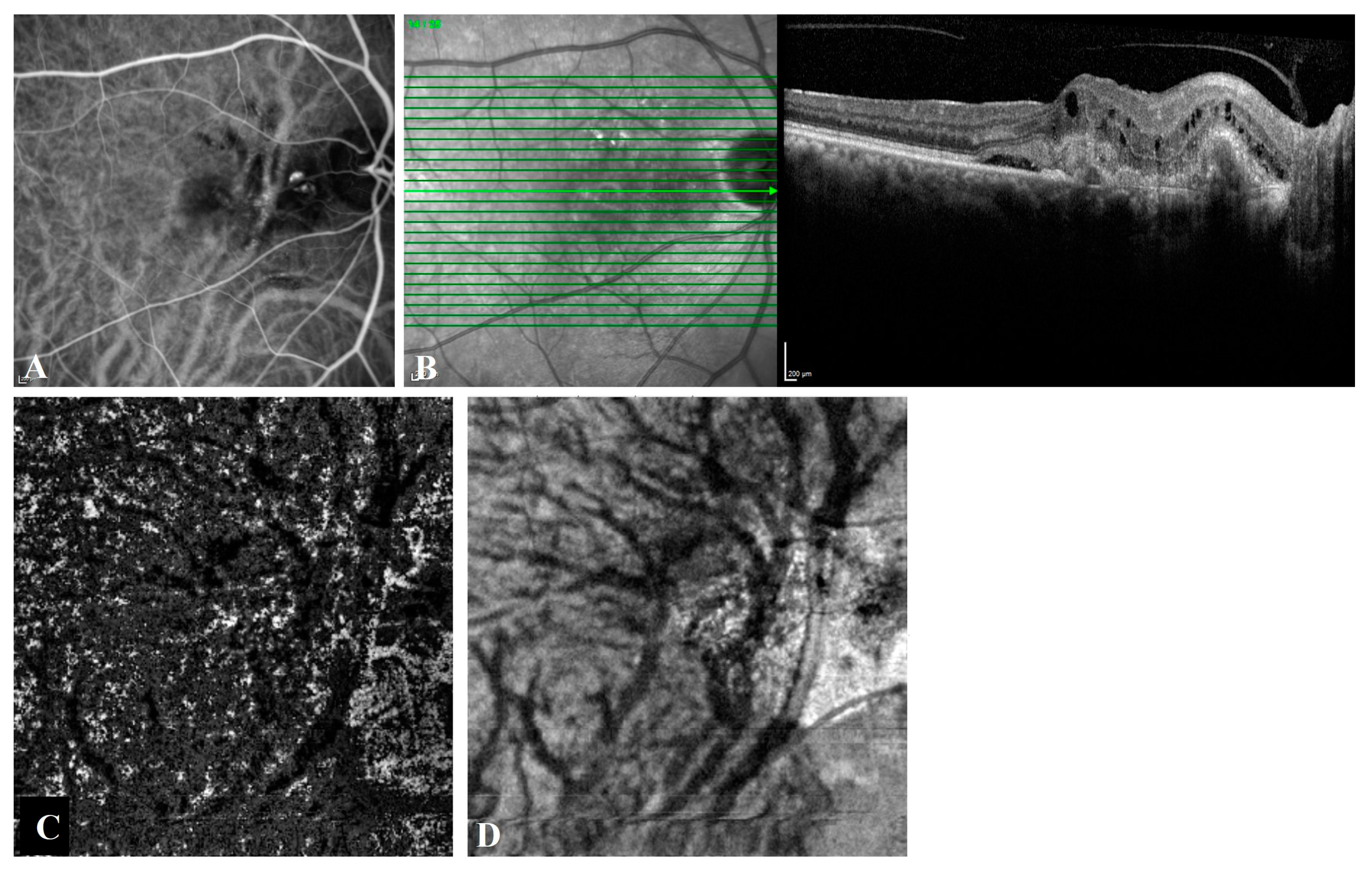Diagnostics 13 00138 g002 Diagnostics 13 00138 g002