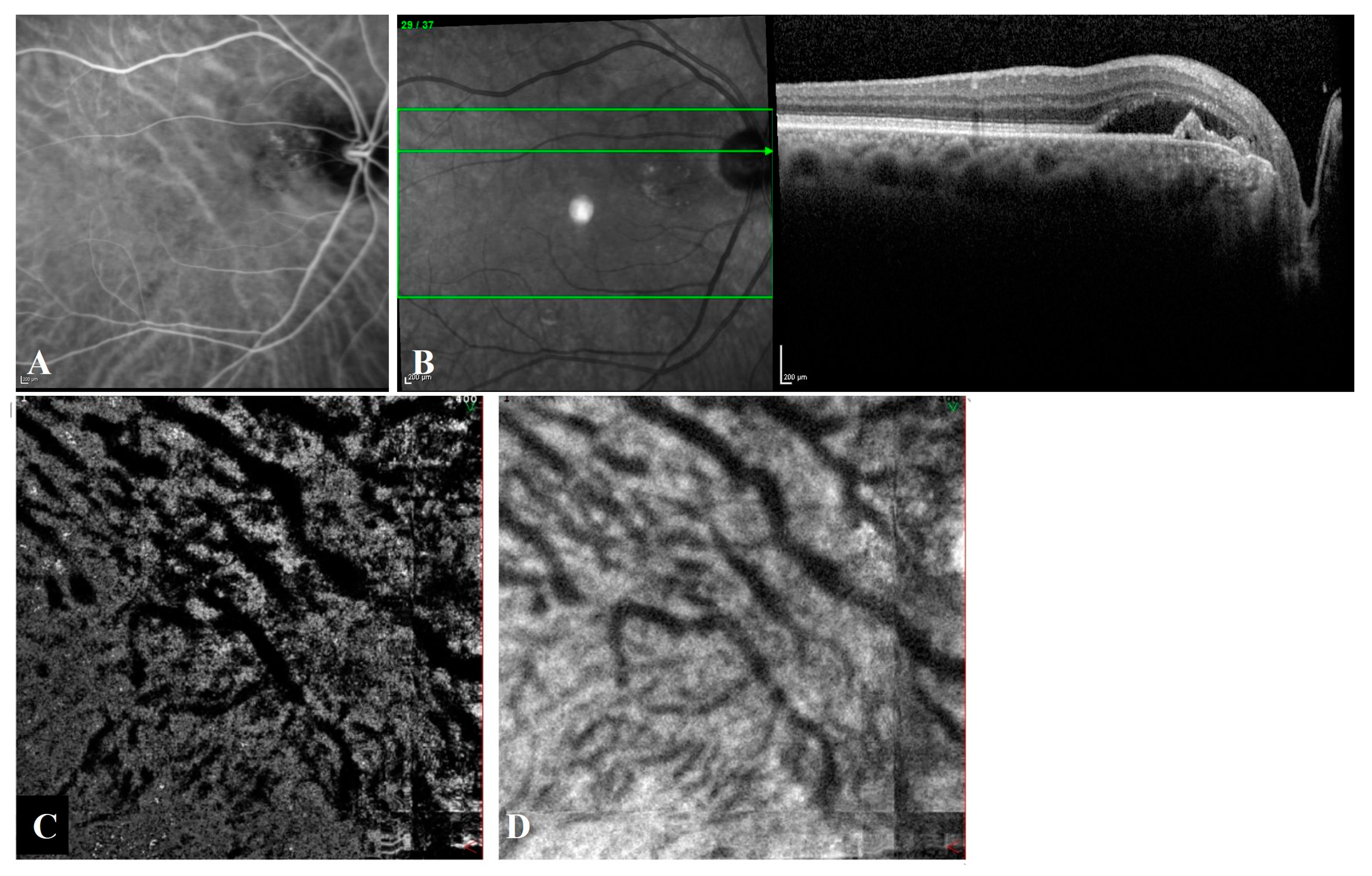 Diagnostics 13 00138 g003 Diagnostics 13 00138 g003