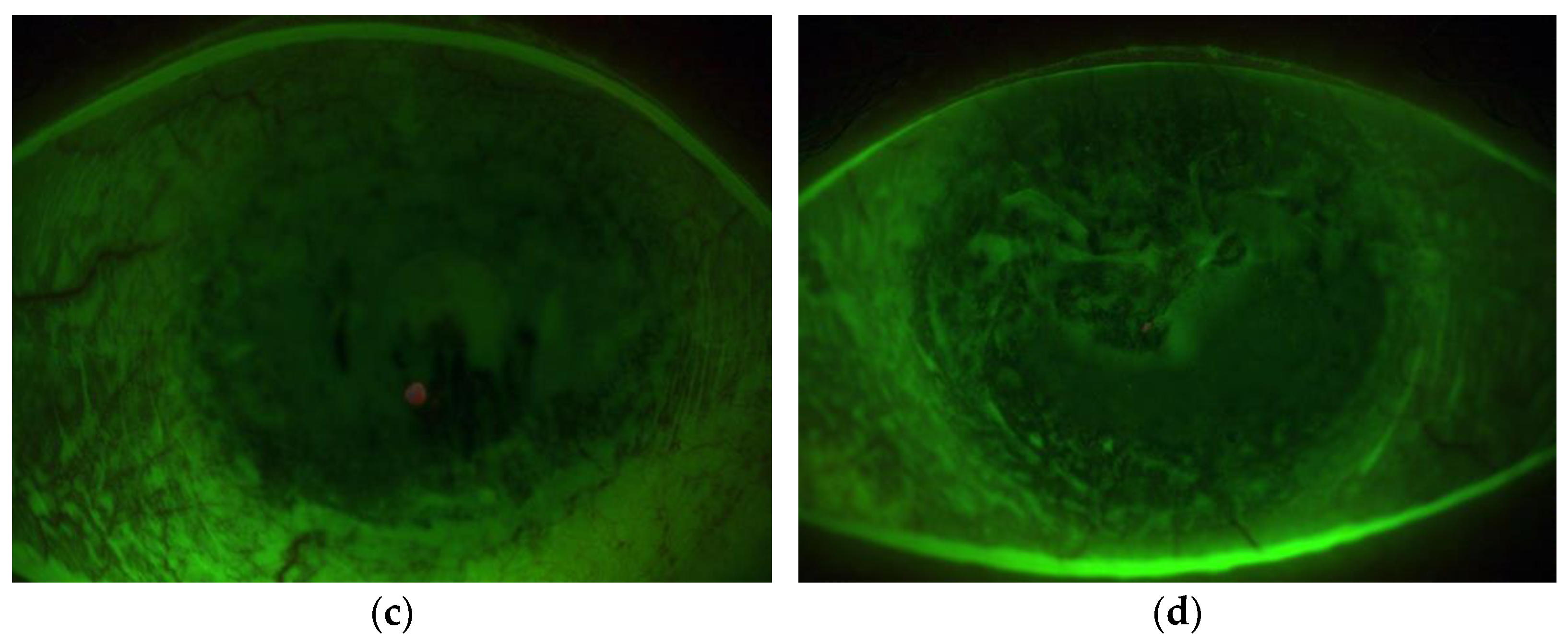 Diagnostics 13 00199 g003b