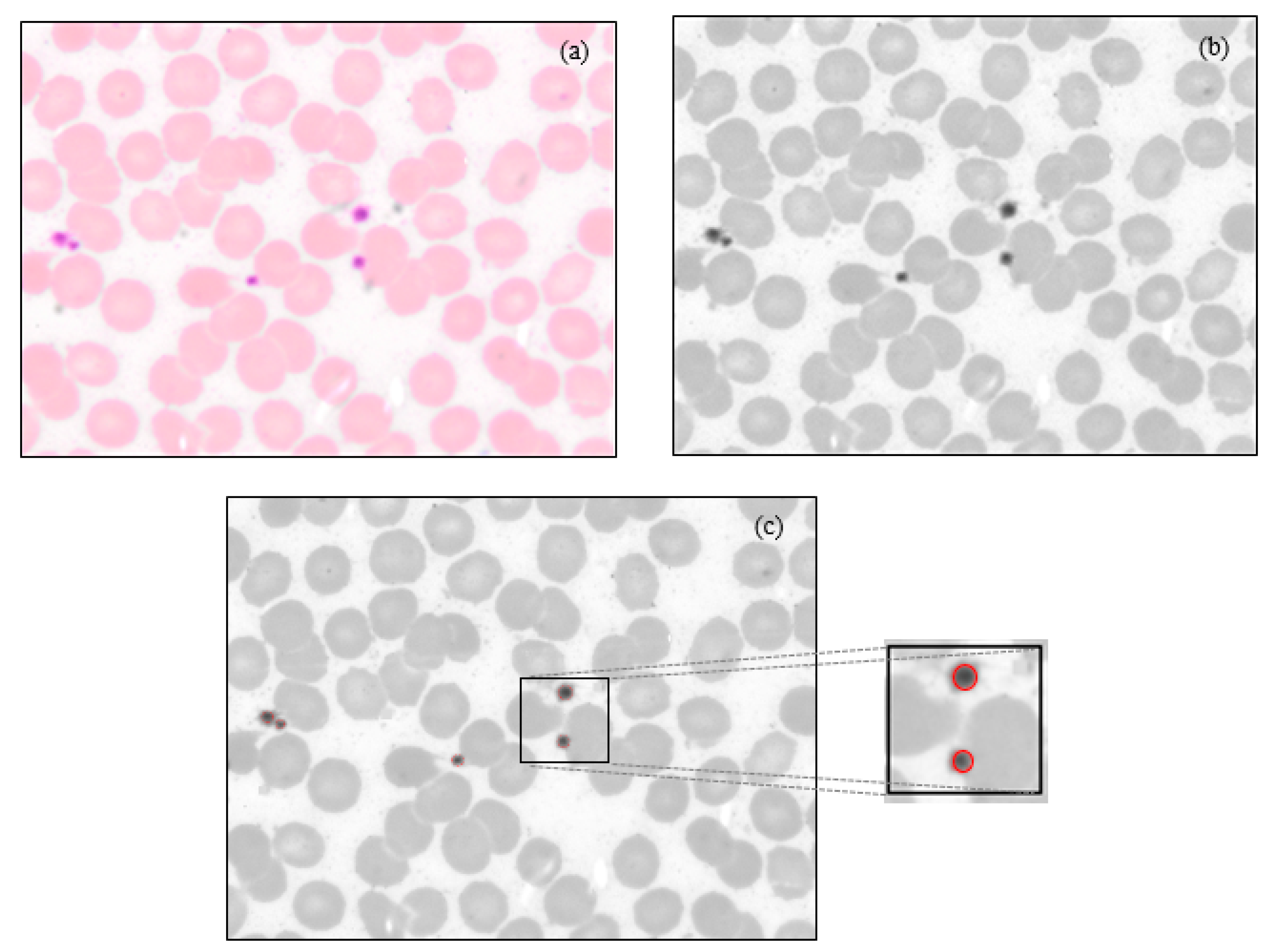 Diagnostics | Free Full-Text | Machine Learning-Based Detection Of ...