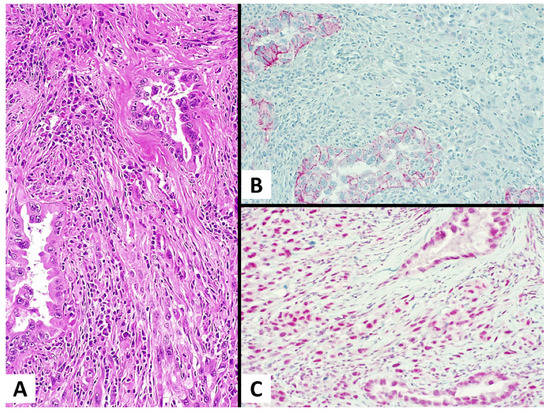 Diagnostics | Free Full-Text | Immunohistochemistry for Claudin-4 and ...