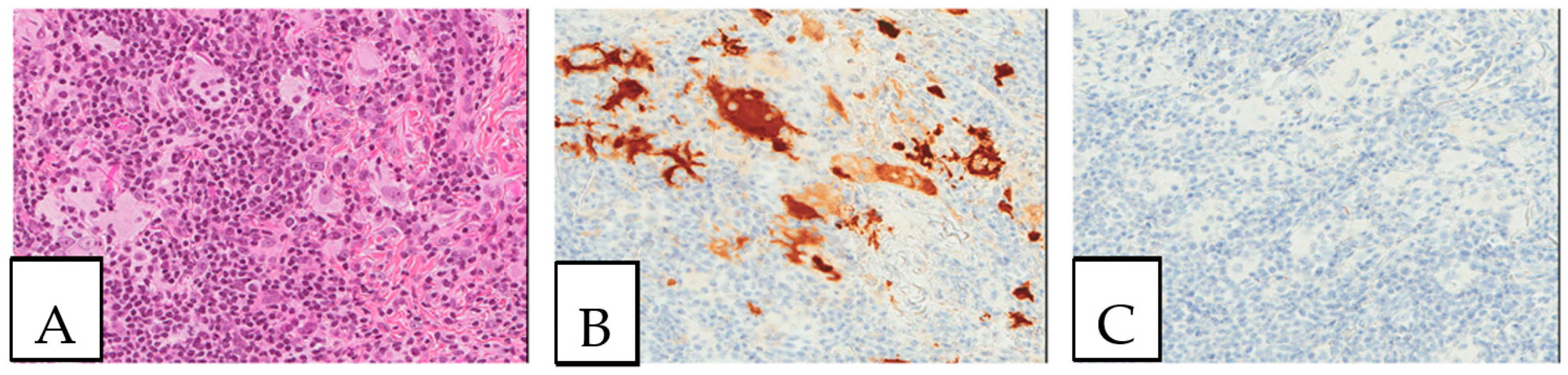 Diagnostics 13 00271 g006 Diagnostics 13 00271 g006