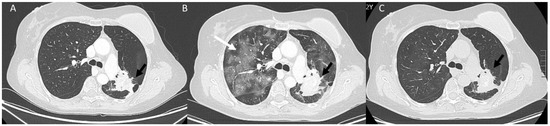 Diagnostics | Free Full-Text | Immunotherapy Assessment: A New Paradigm ...