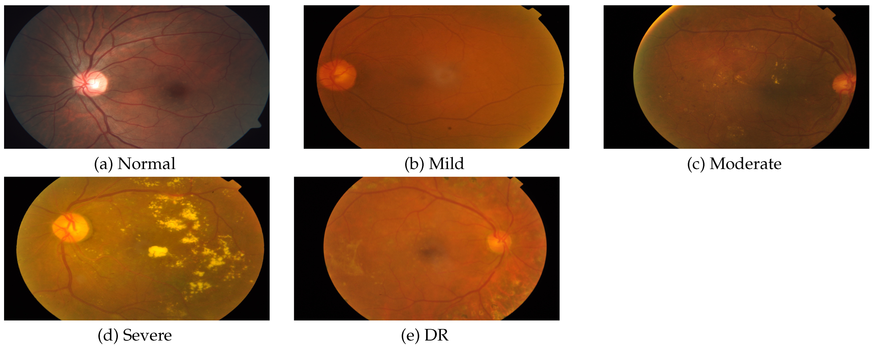 Diagnostics 13 00345 g004 Diagnostics 13 00345 g004
