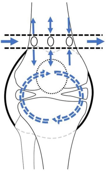 Septic Arthritis: An Evidence-Based Review of Diagnosis and Image