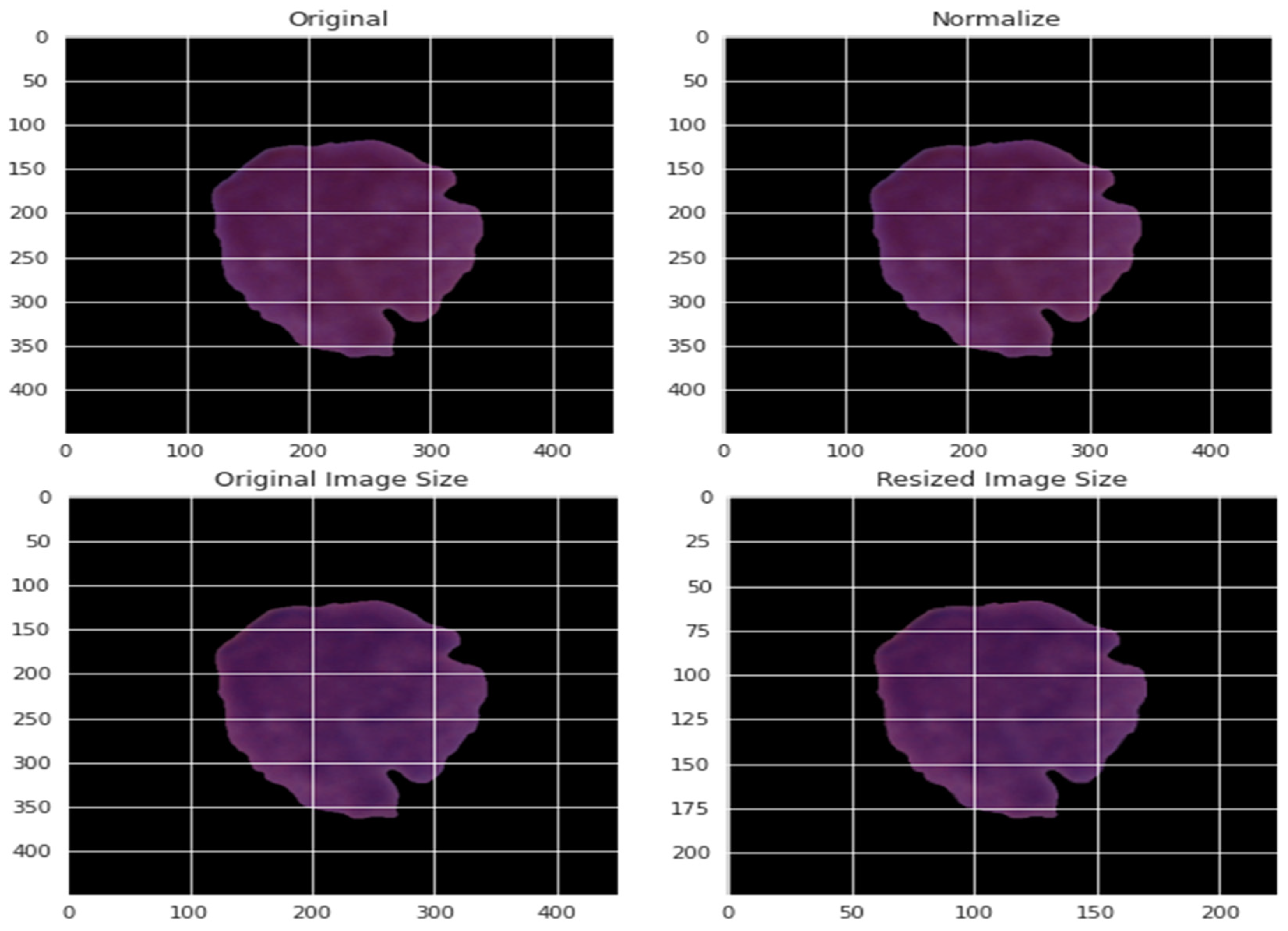 Diagnostics 13 00404 g004 Diagnostics 13 00404 g004