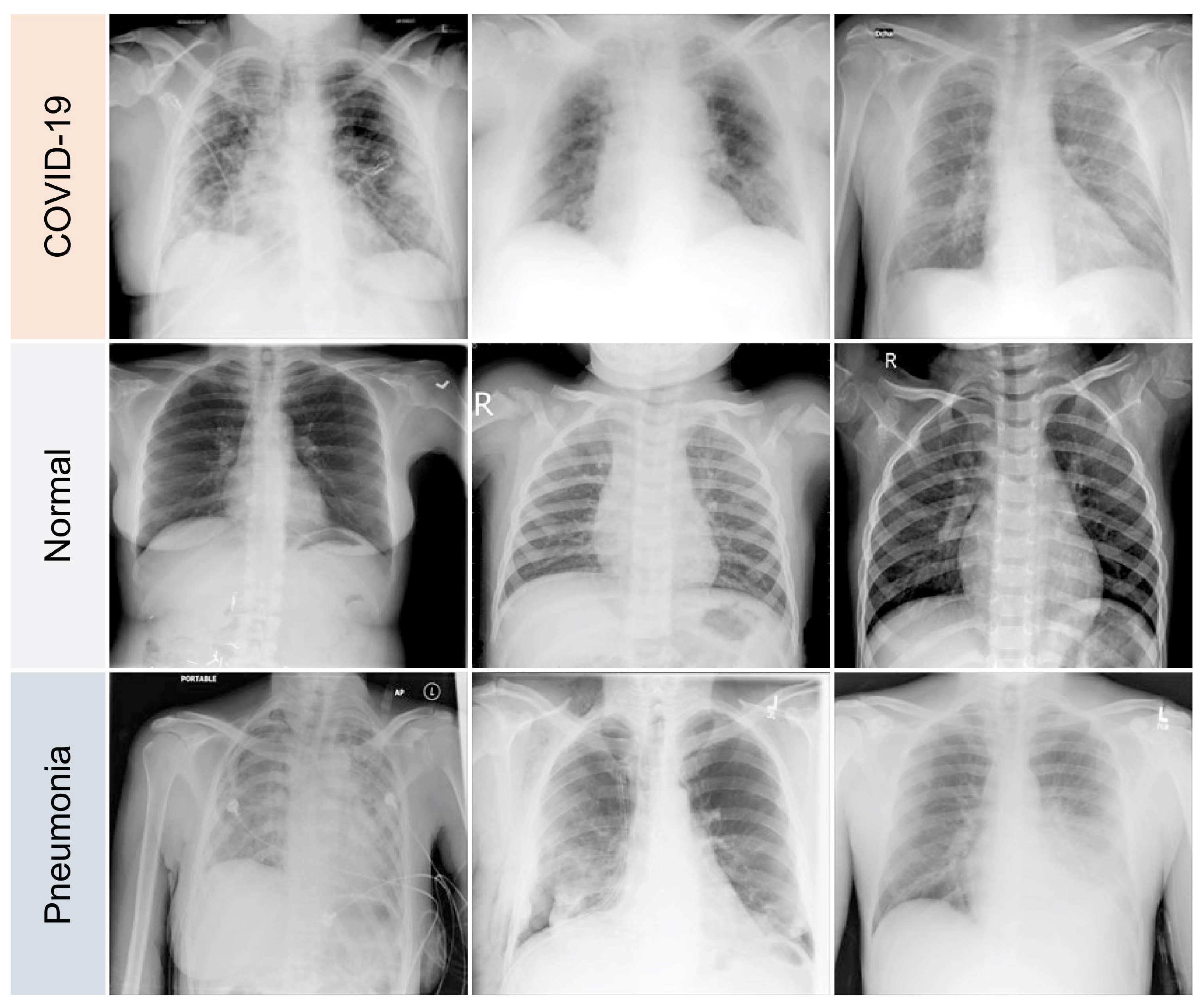Diagnostics 13 00441 g003 Diagnostics 13 00441 g003