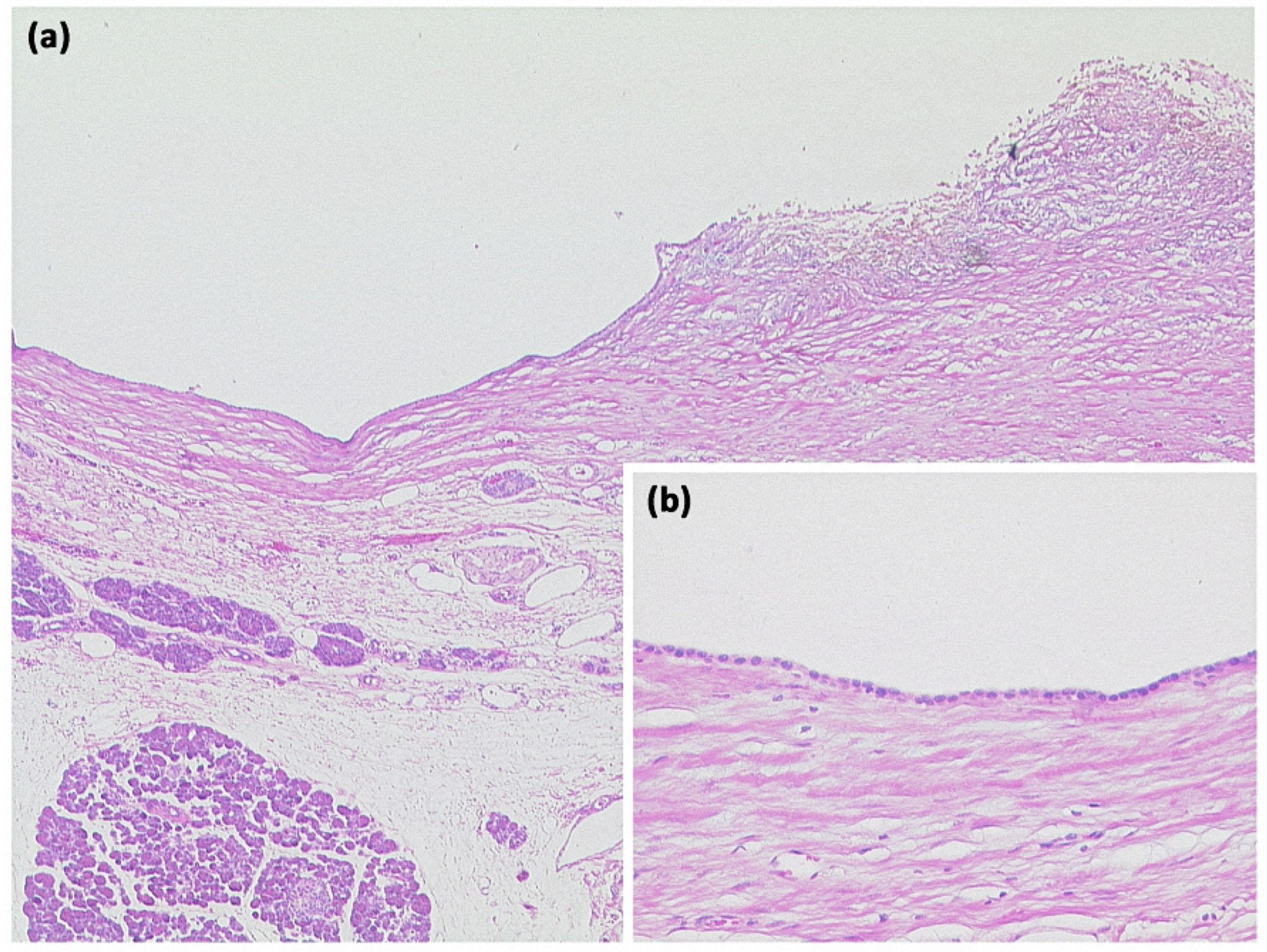 Diagnostics 13 00454 g004 Diagnostics 13 00454 g004