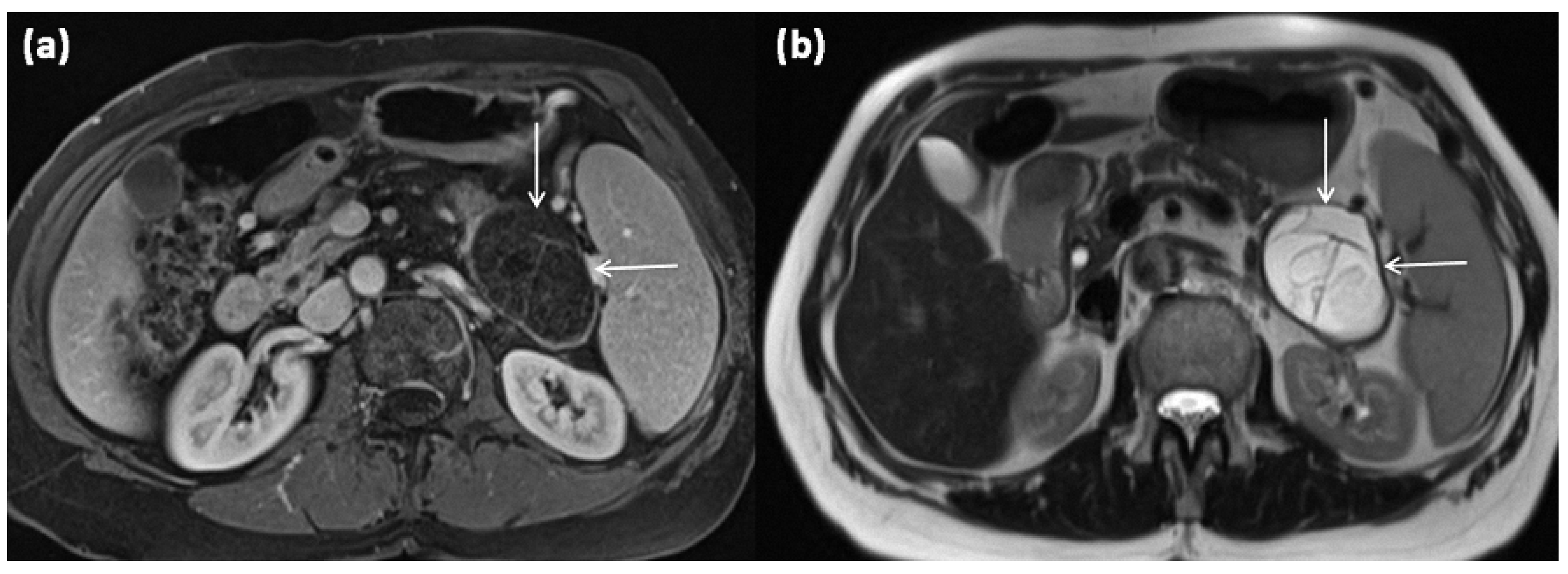 Diagnostics 13 00454 g005 Diagnostics 13 00454 g005