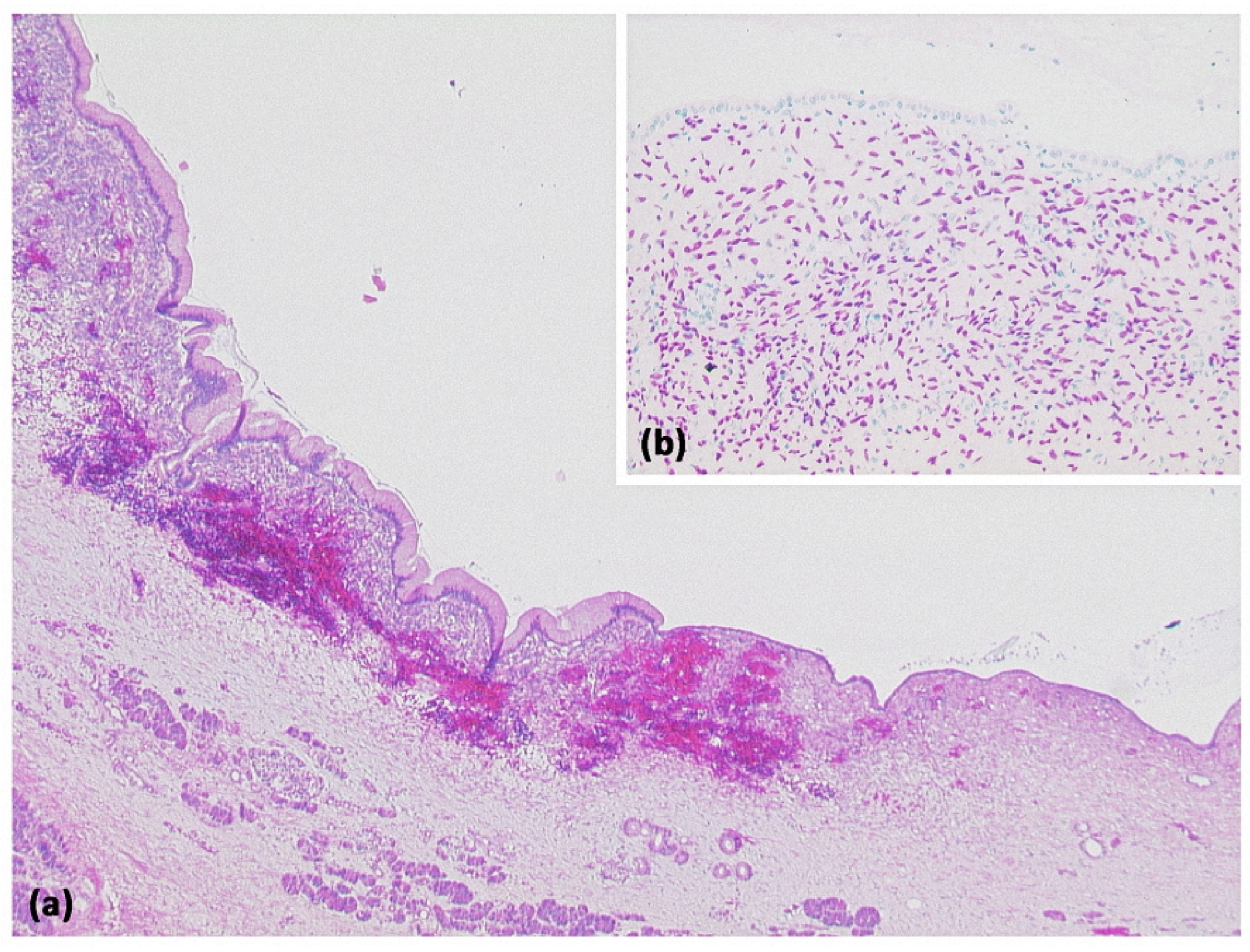 Diagnostics 13 00454 g006 Diagnostics 13 00454 g006