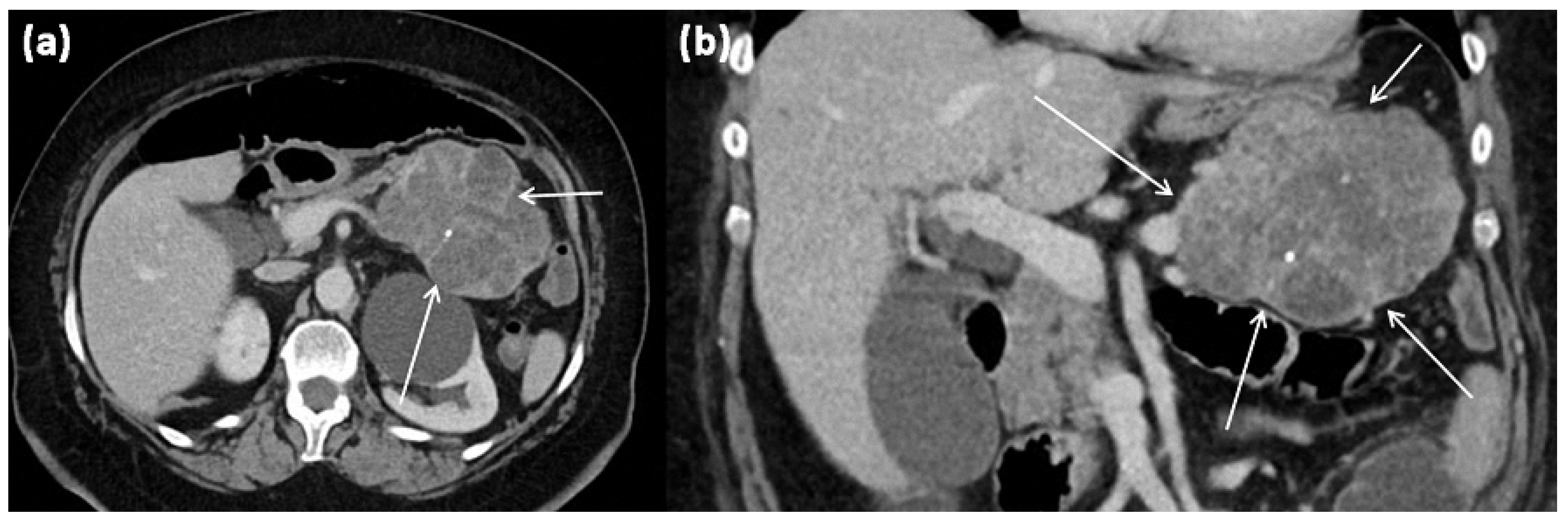 Diagnostics 13 00454 g007 Diagnostics 13 00454 g007