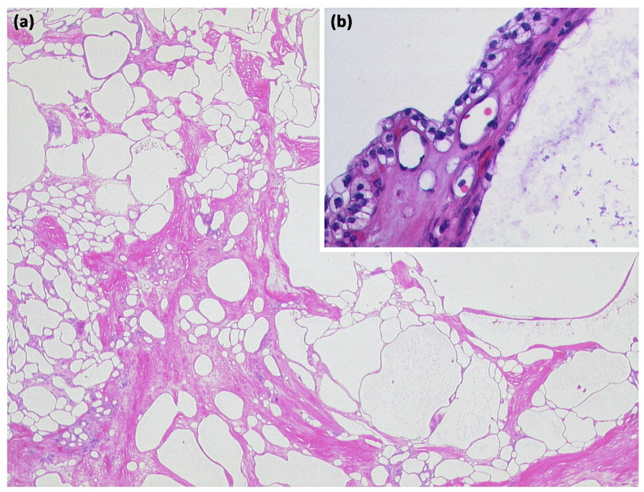 Diagnostics 13 00454 g008 Diagnostics 13 00454 g008