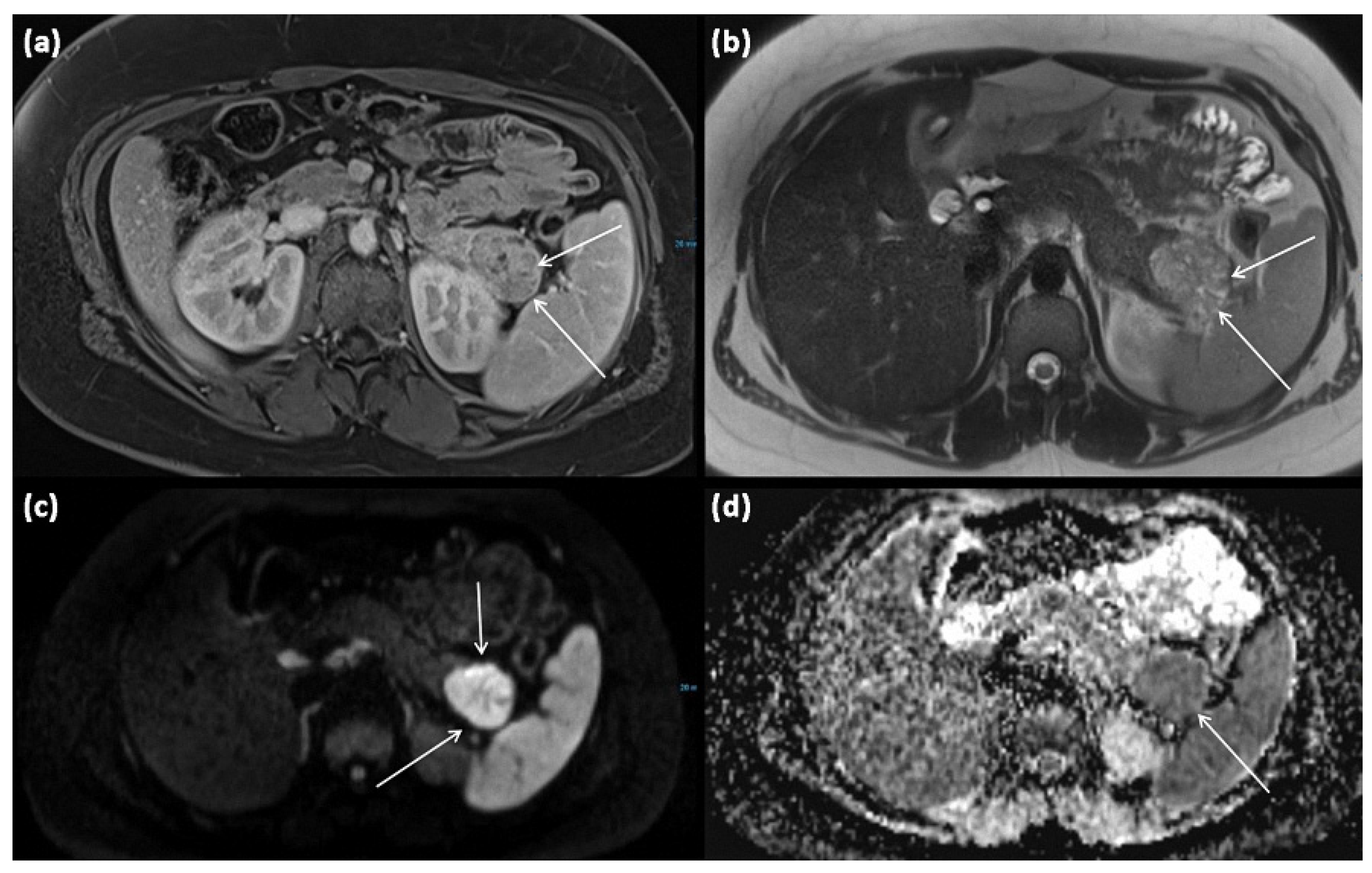 Diagnostics 13 00454 g009 Diagnostics 13 00454 g009
