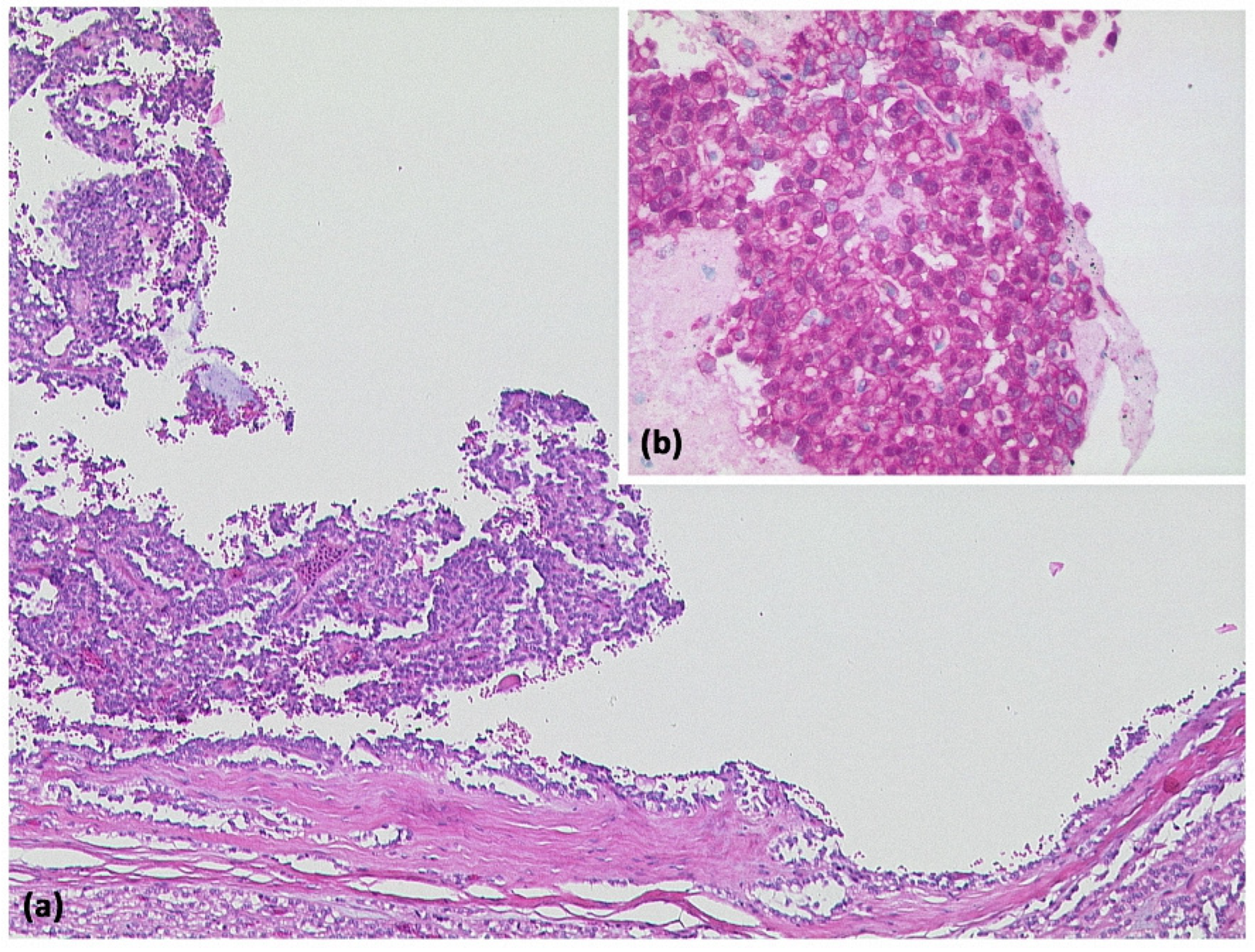 Diagnostics 13 00454 g010 Diagnostics 13 00454 g010