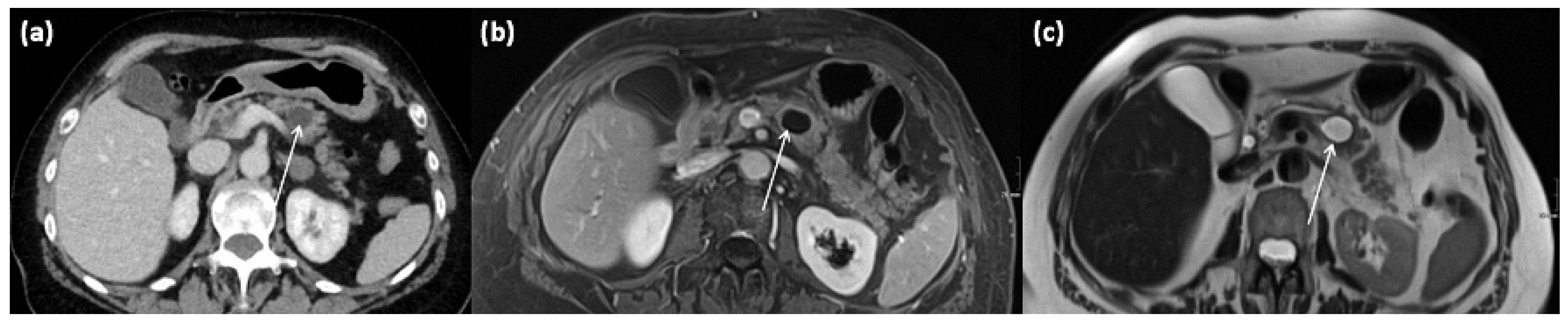 Diagnostics 13 00454 g011 Diagnostics 13 00454 g011