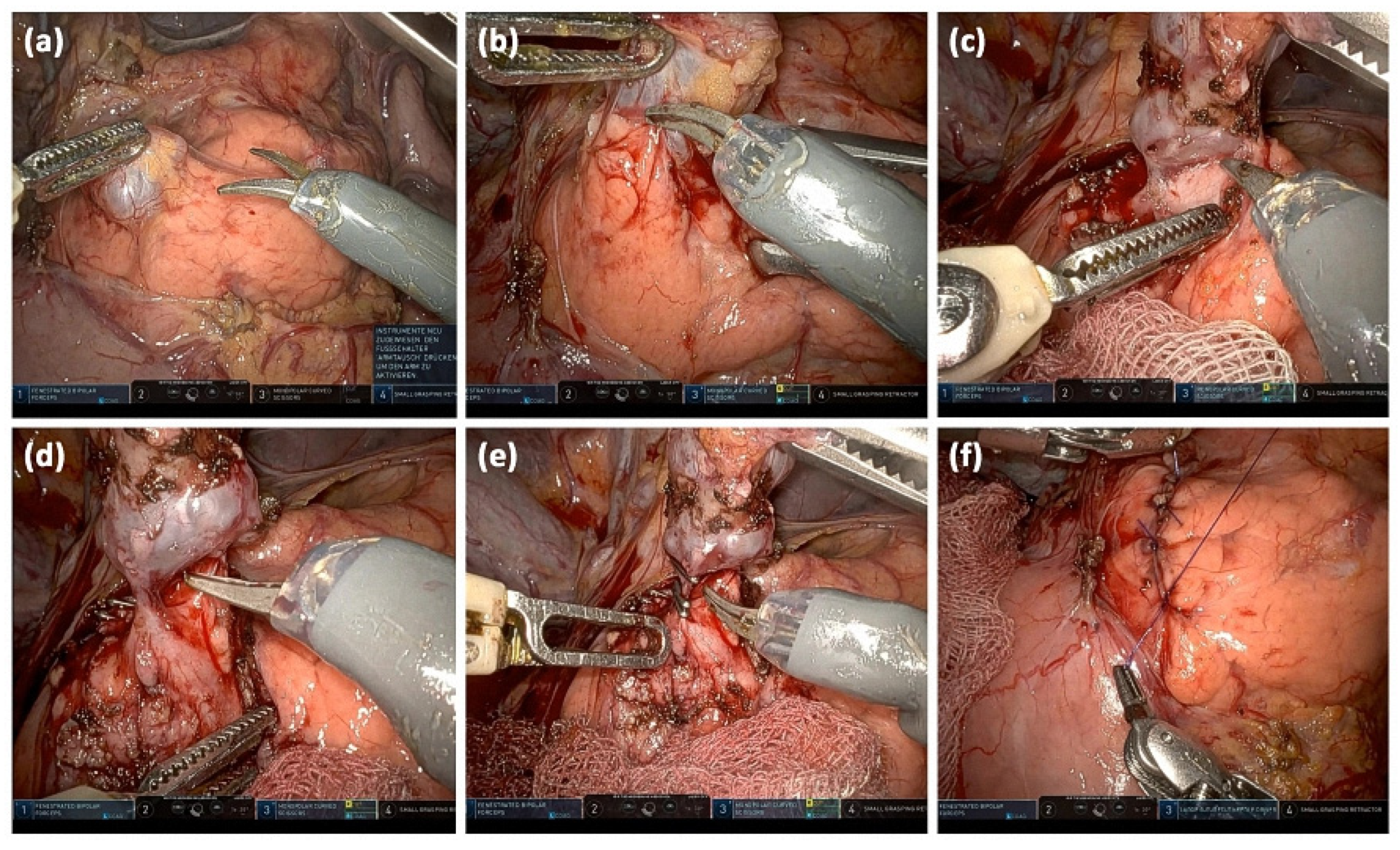 Diagnostics 13 00454 g013 Diagnostics 13 00454 g013