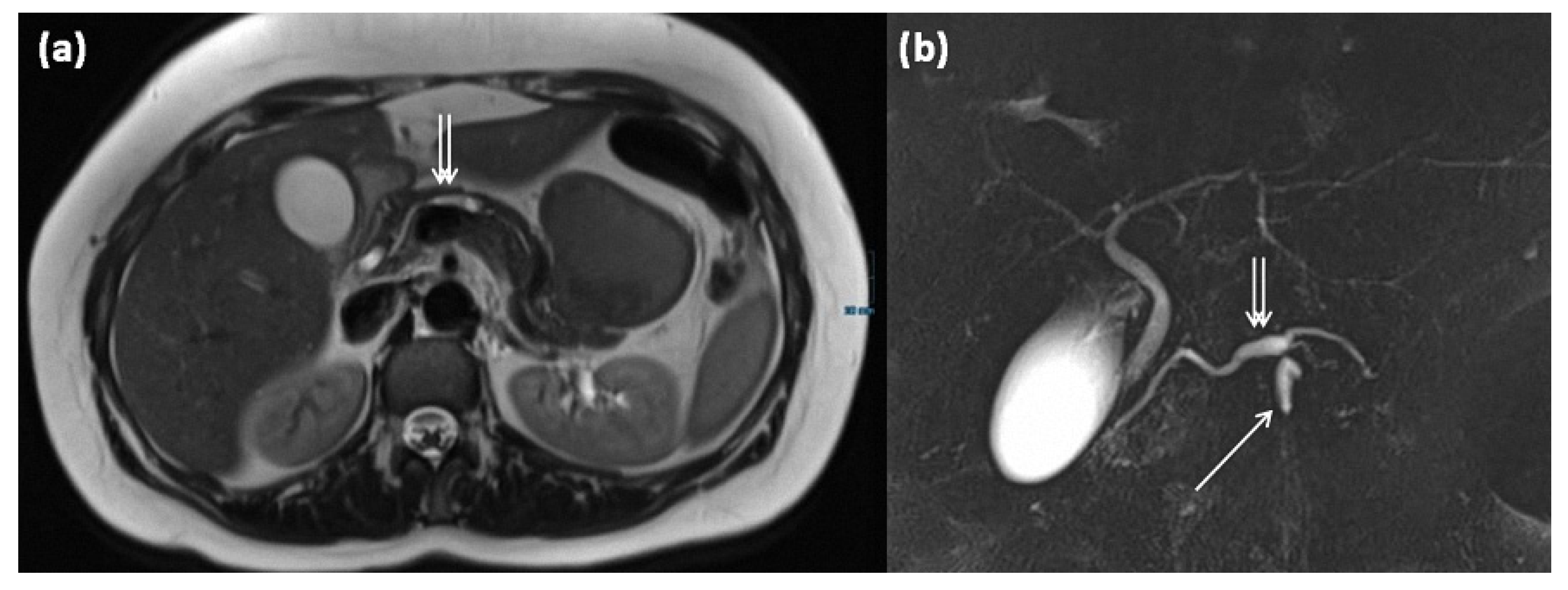 Diagnostics 13 00454 g015 Diagnostics 13 00454 g015